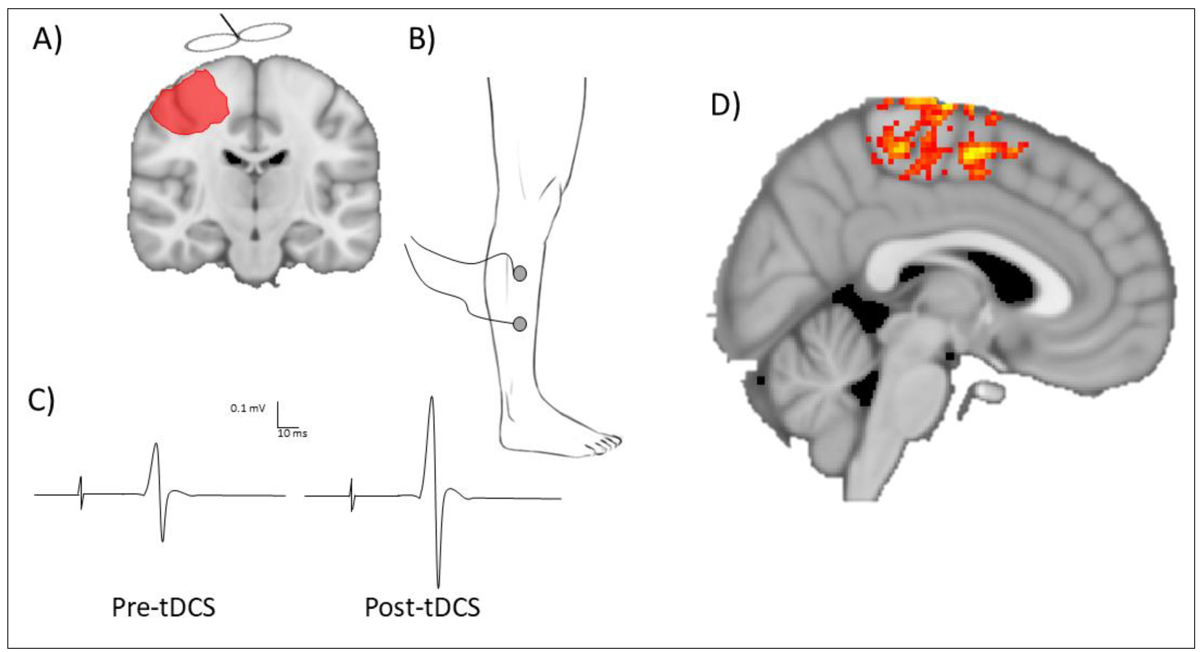Brainsci 10 00310 g003 Brainsci 10 00310 g003