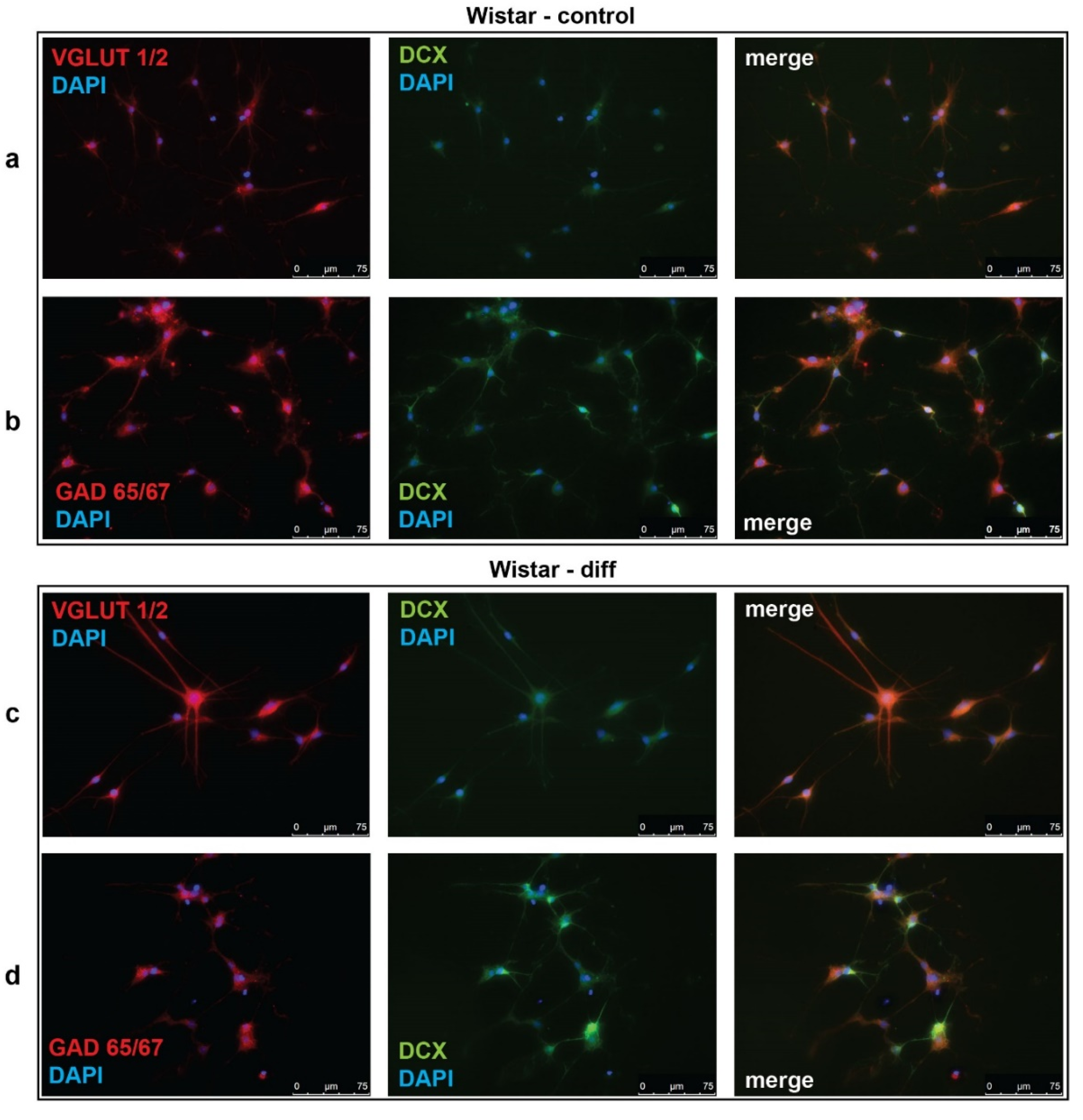 Brainsci 10 00311 g003