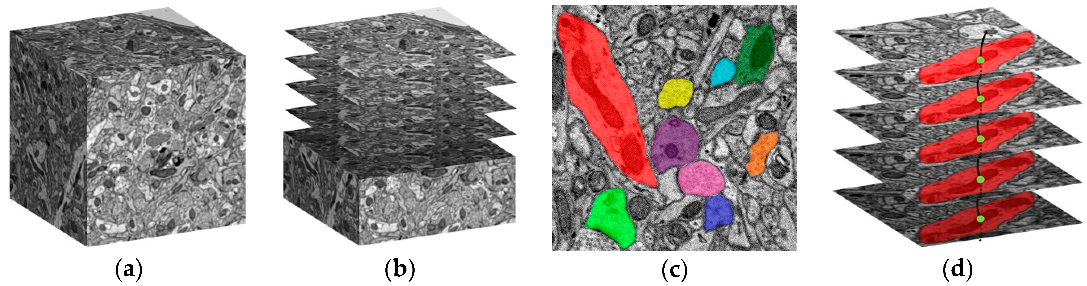 Brainsci 10 00314 g001