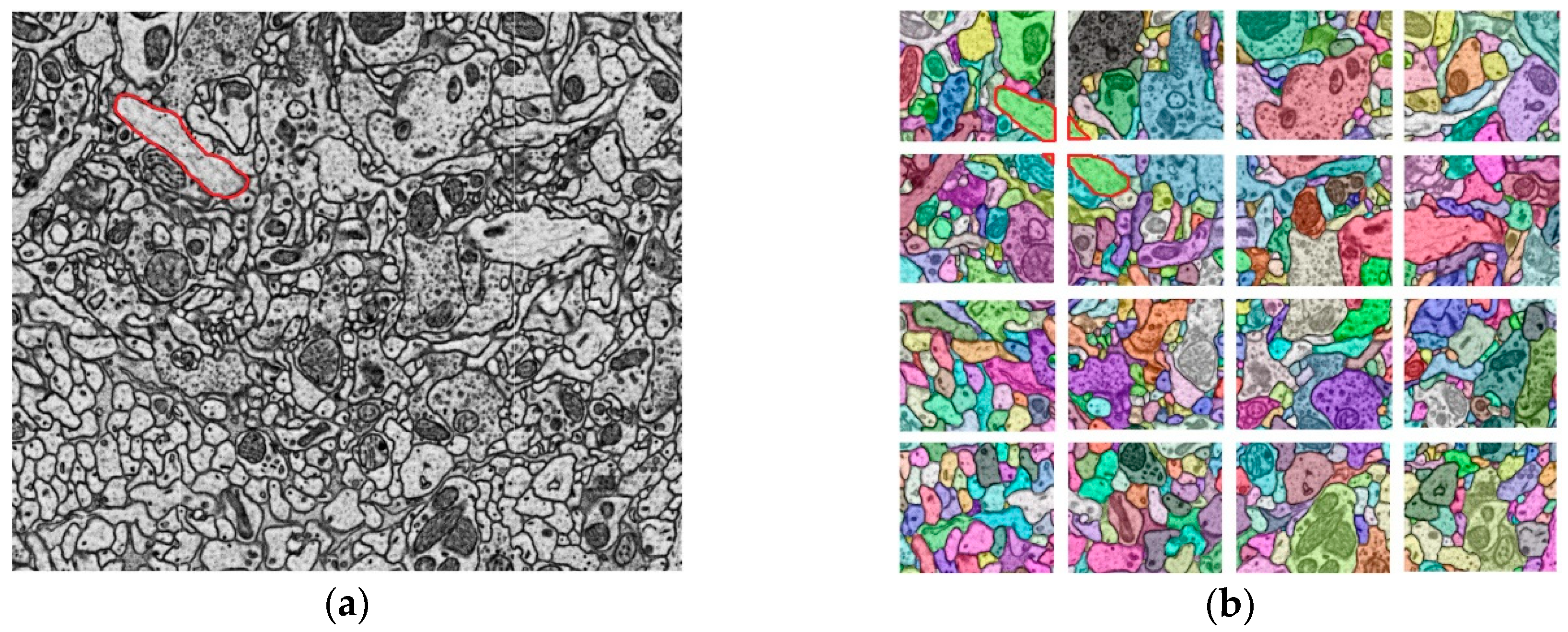 Brainsci 10 00314 g005