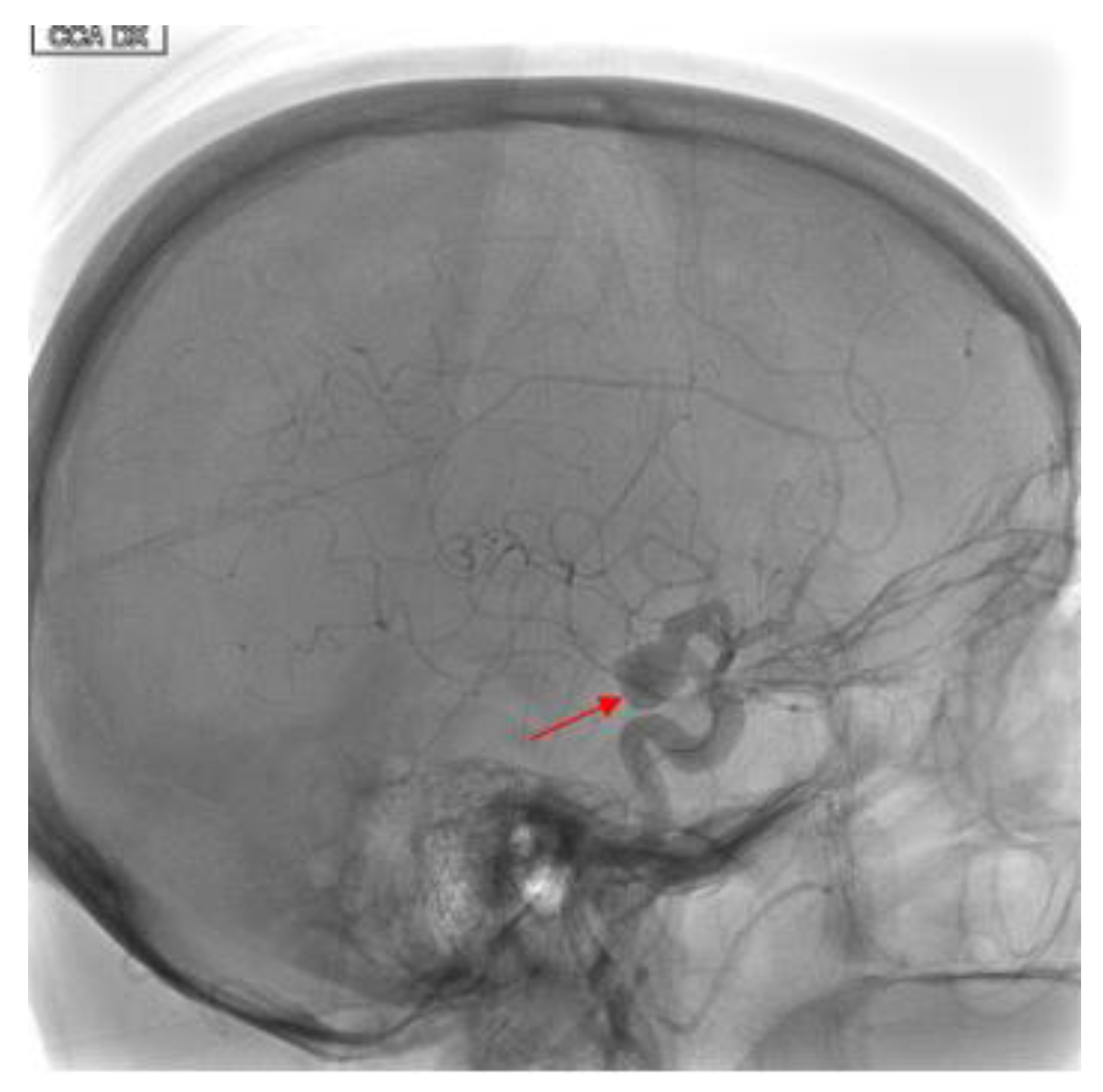 Brainsci 10 00320 g001