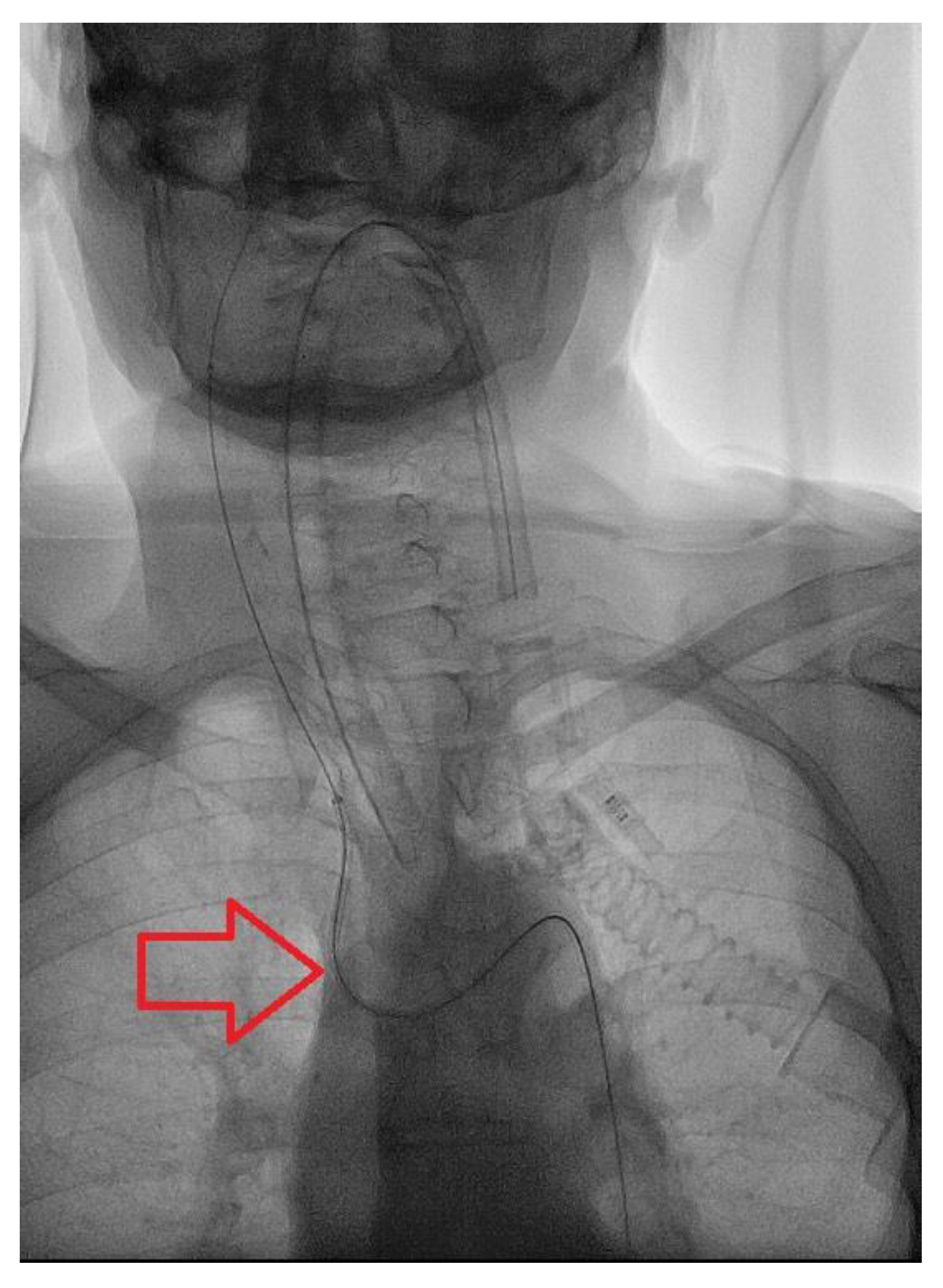 Brainsci 10 00320 g002
