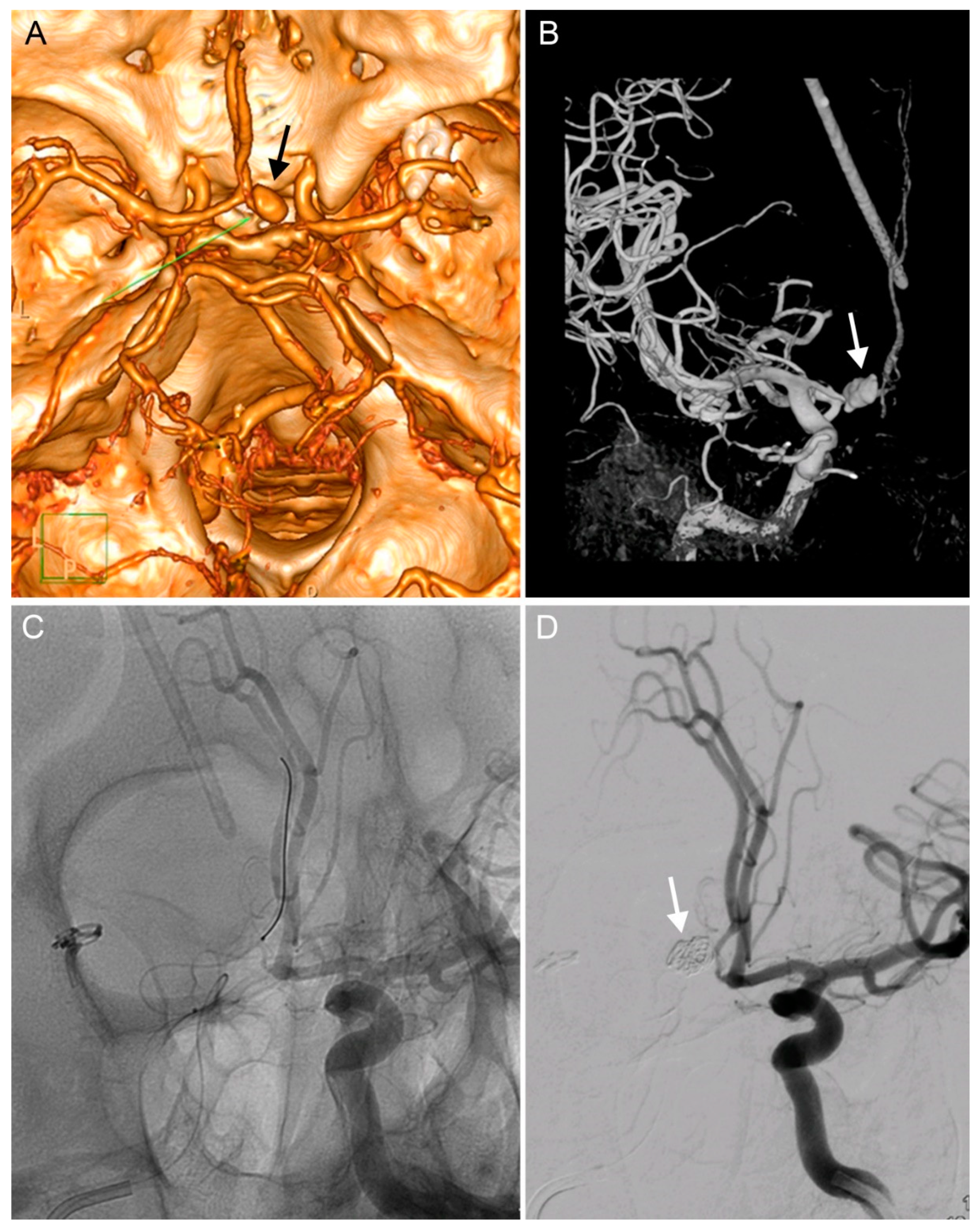 Brainsci 10 00357 g002