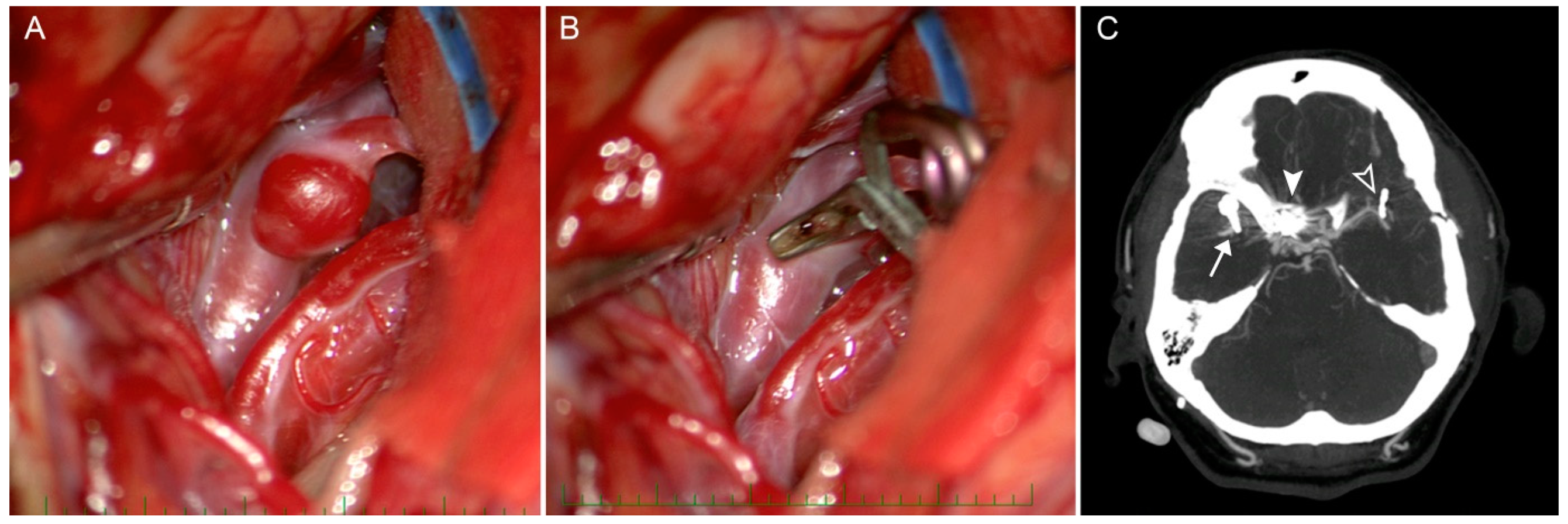 Brainsci 10 00357 g003