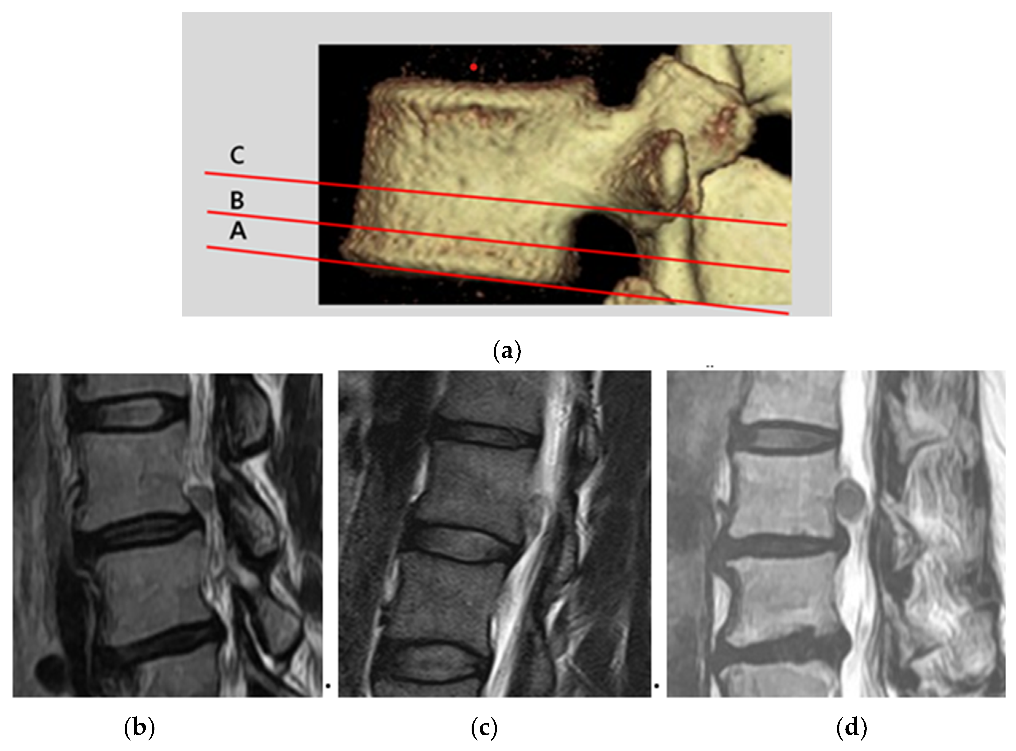 Brainsci 10 00363 g001