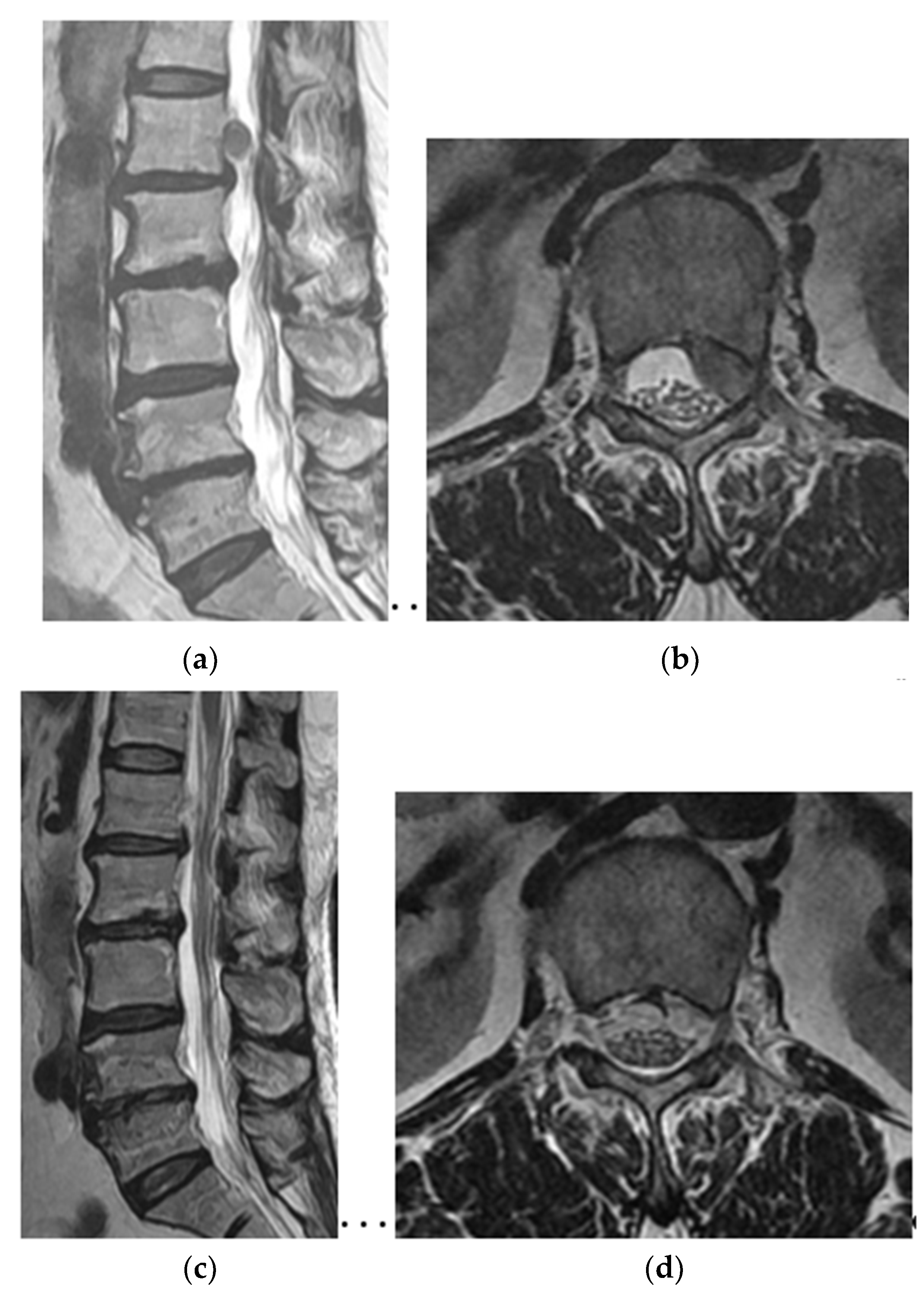 Brainsci 10 00363 g004