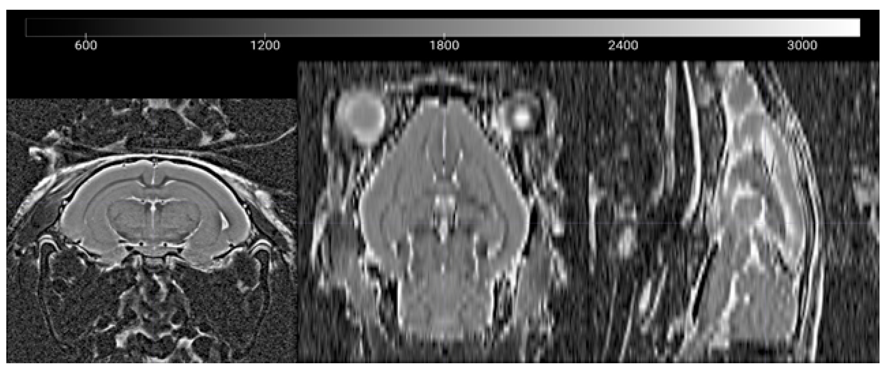 Brainsci 10 00365 g0a1 Brainsci 10 00365 g0a1