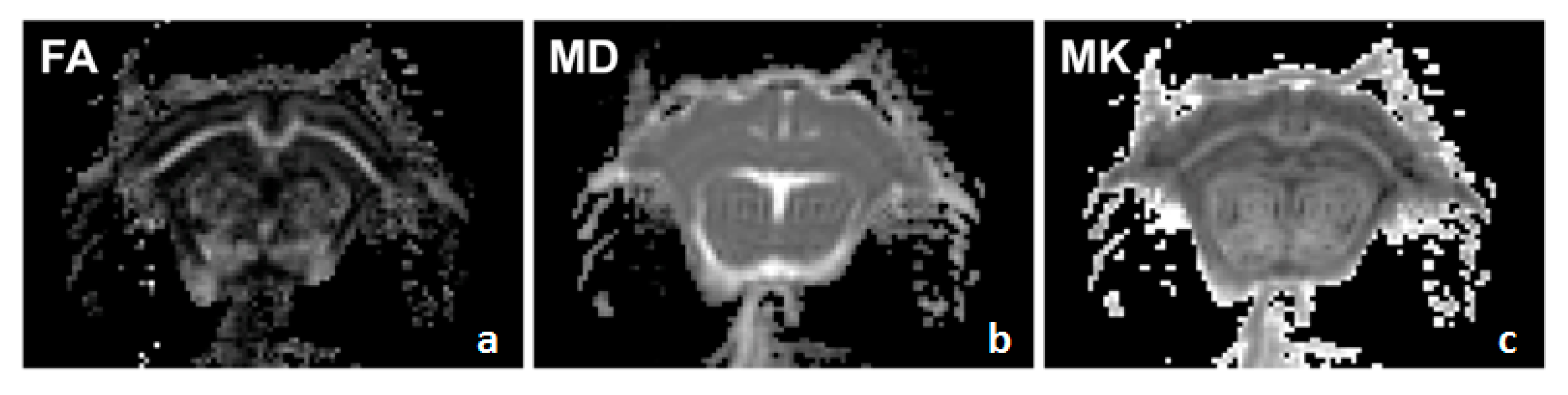 Brainsci 10 00365 g0a2 Brainsci 10 00365 g0a2