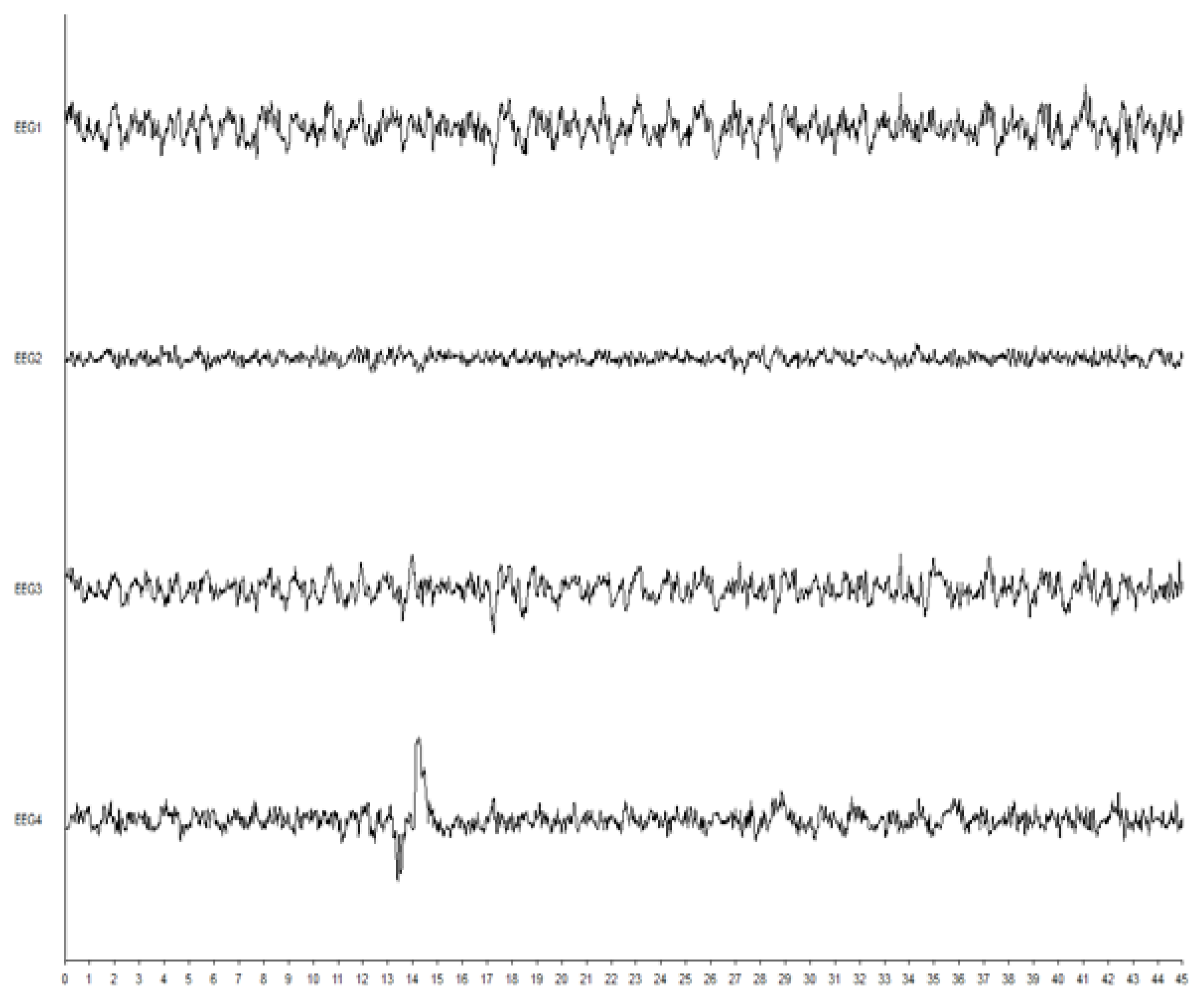 Brainsci 10 00366 g004