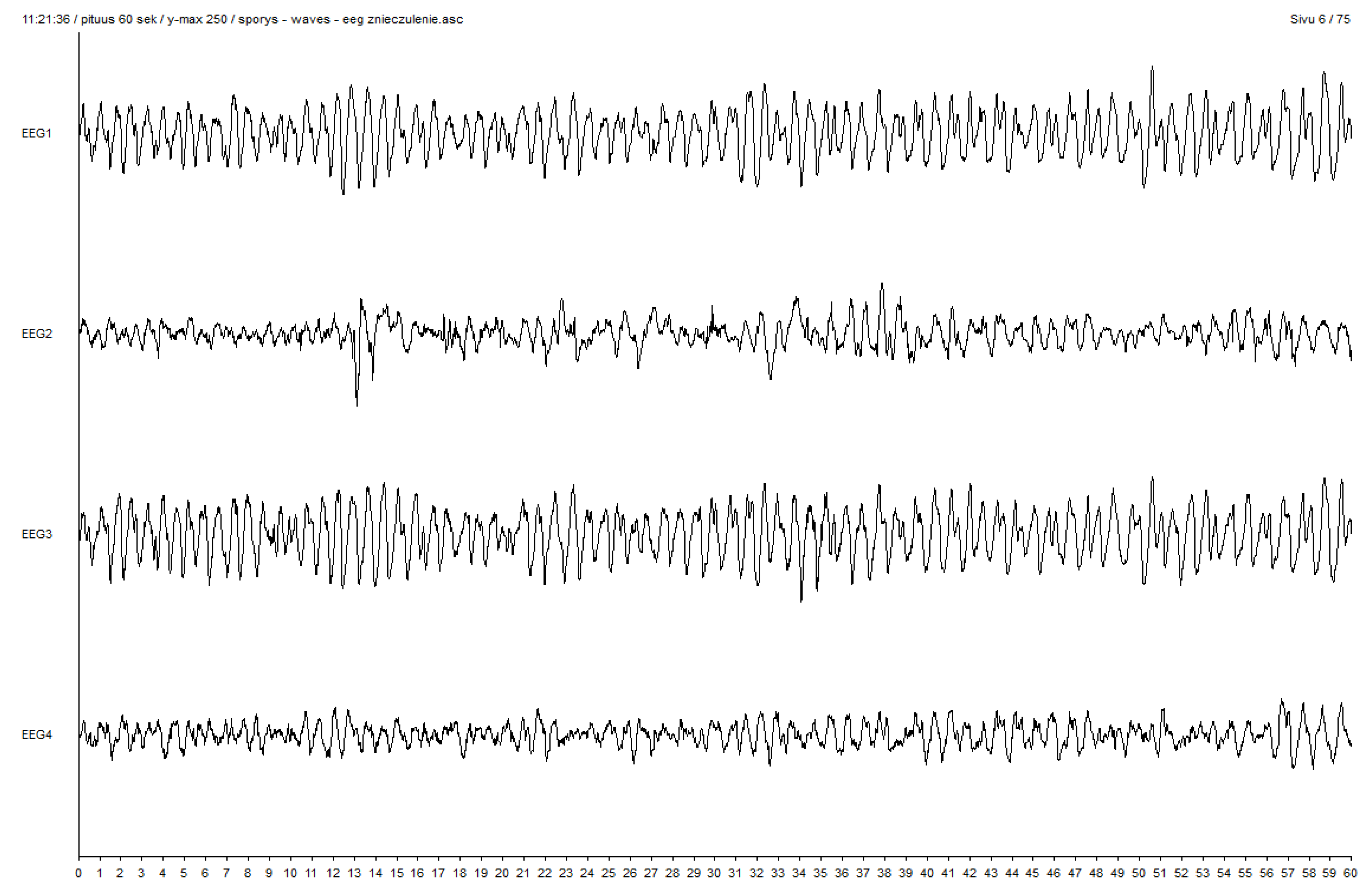 Brainsci 10 00366 g005