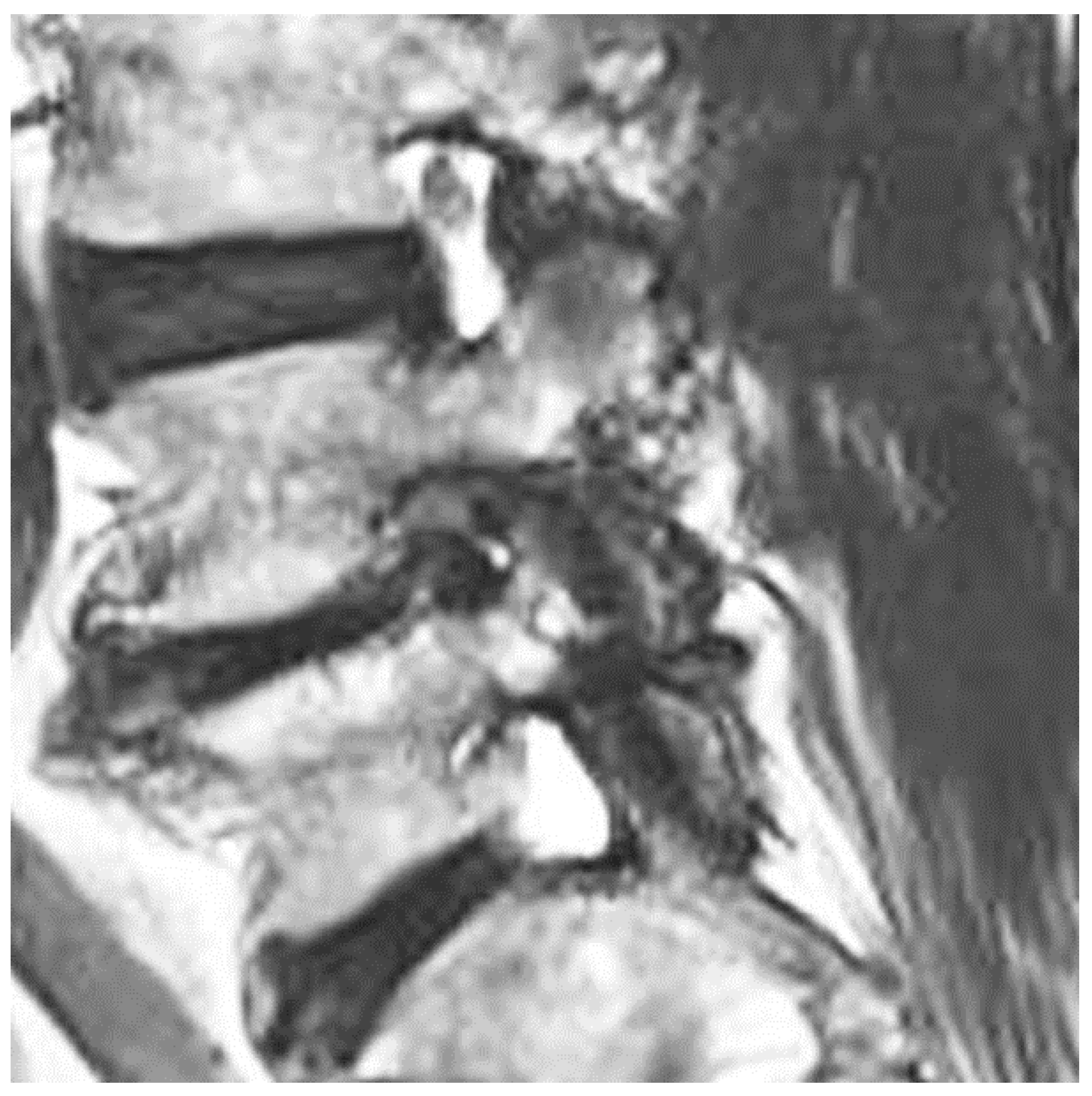 Brainsci 10 00373 g002