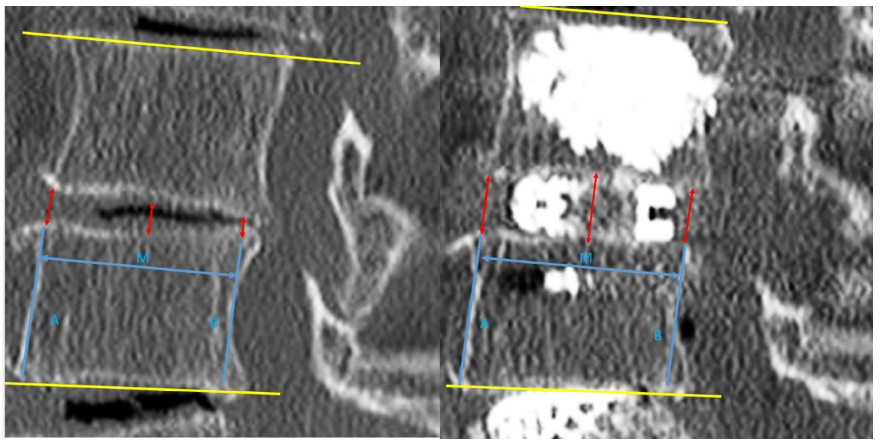 Brainsci 10 00373 g003