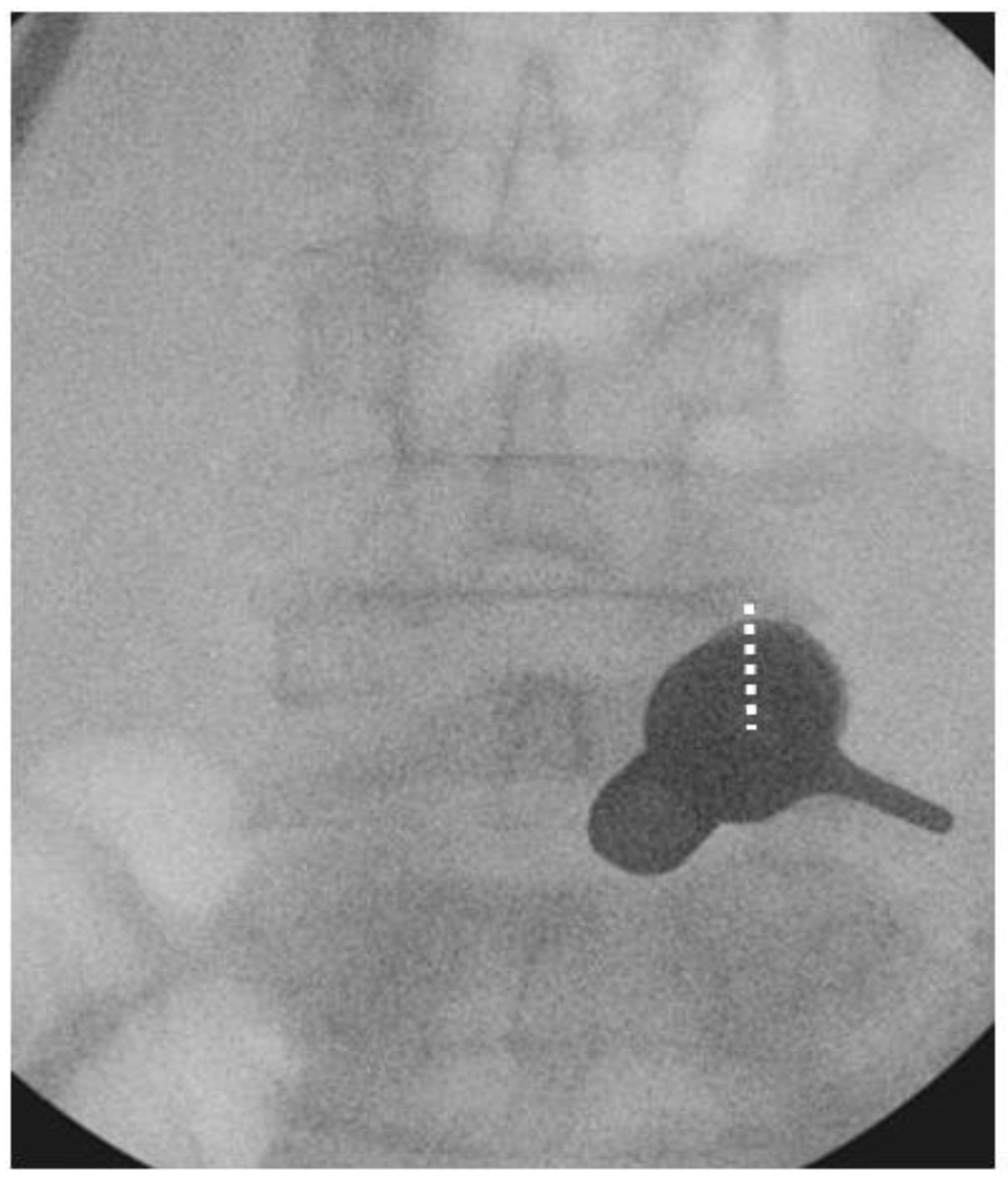 Brainsci 10 00373 g005