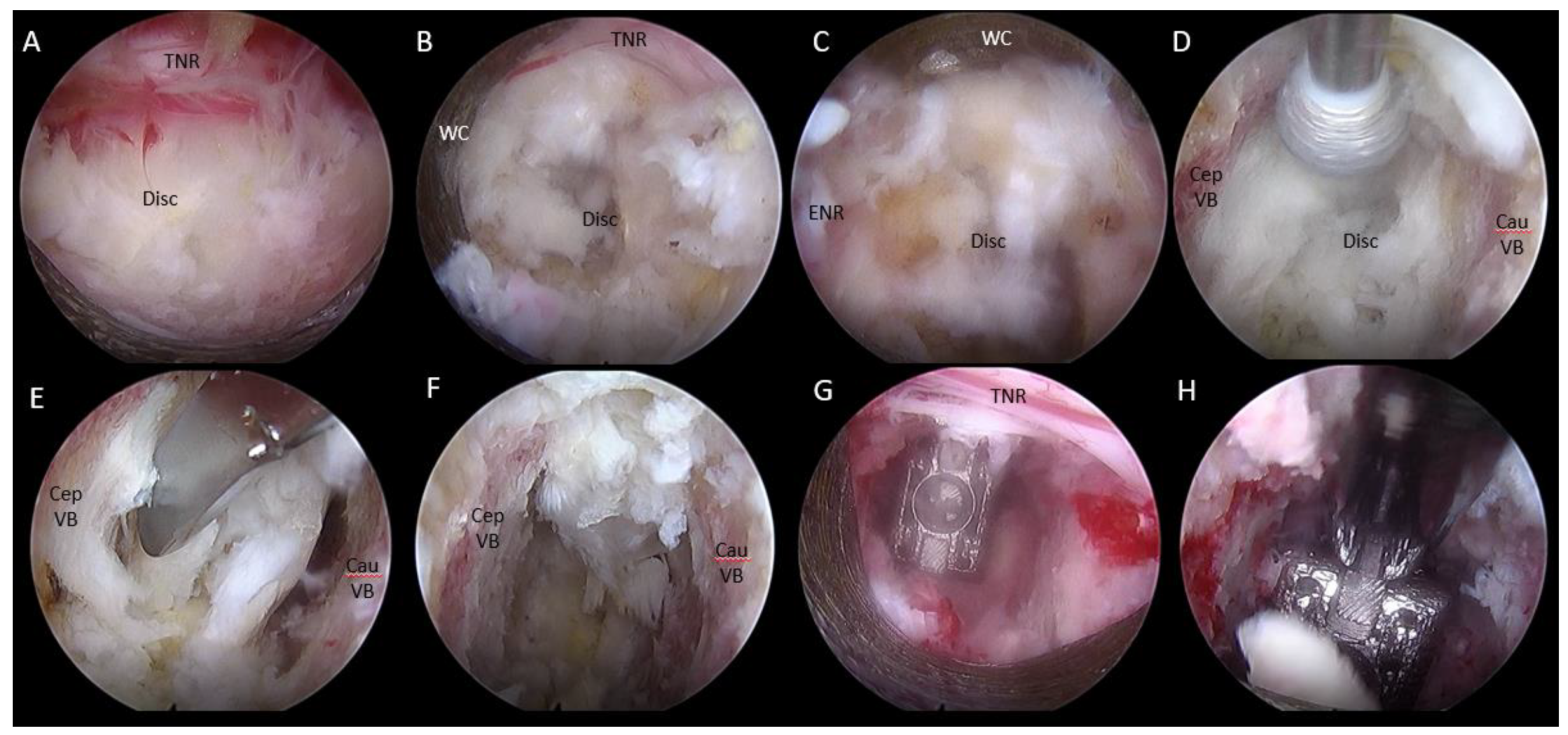 Brainsci 10 00373 g007