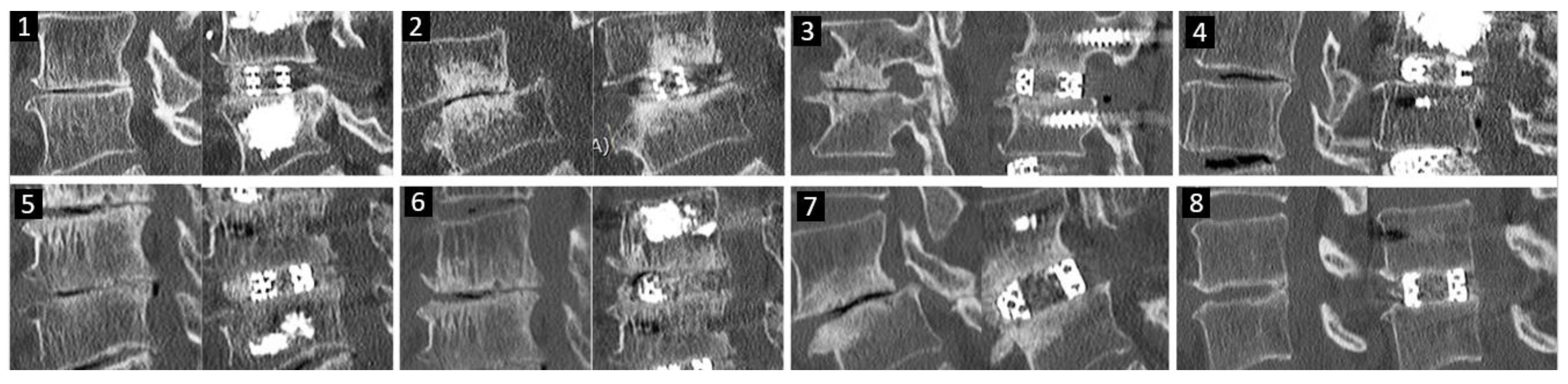 Brainsci 10 00373 g010