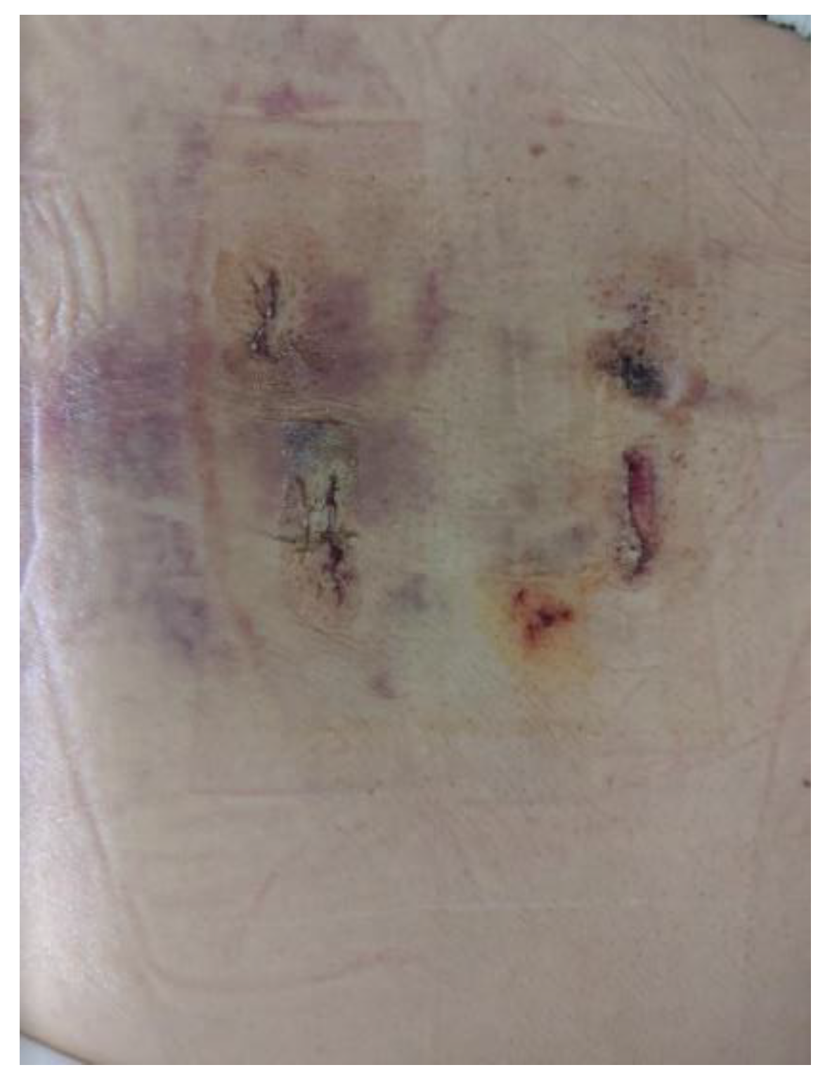 Brainsci 10 00373 g011