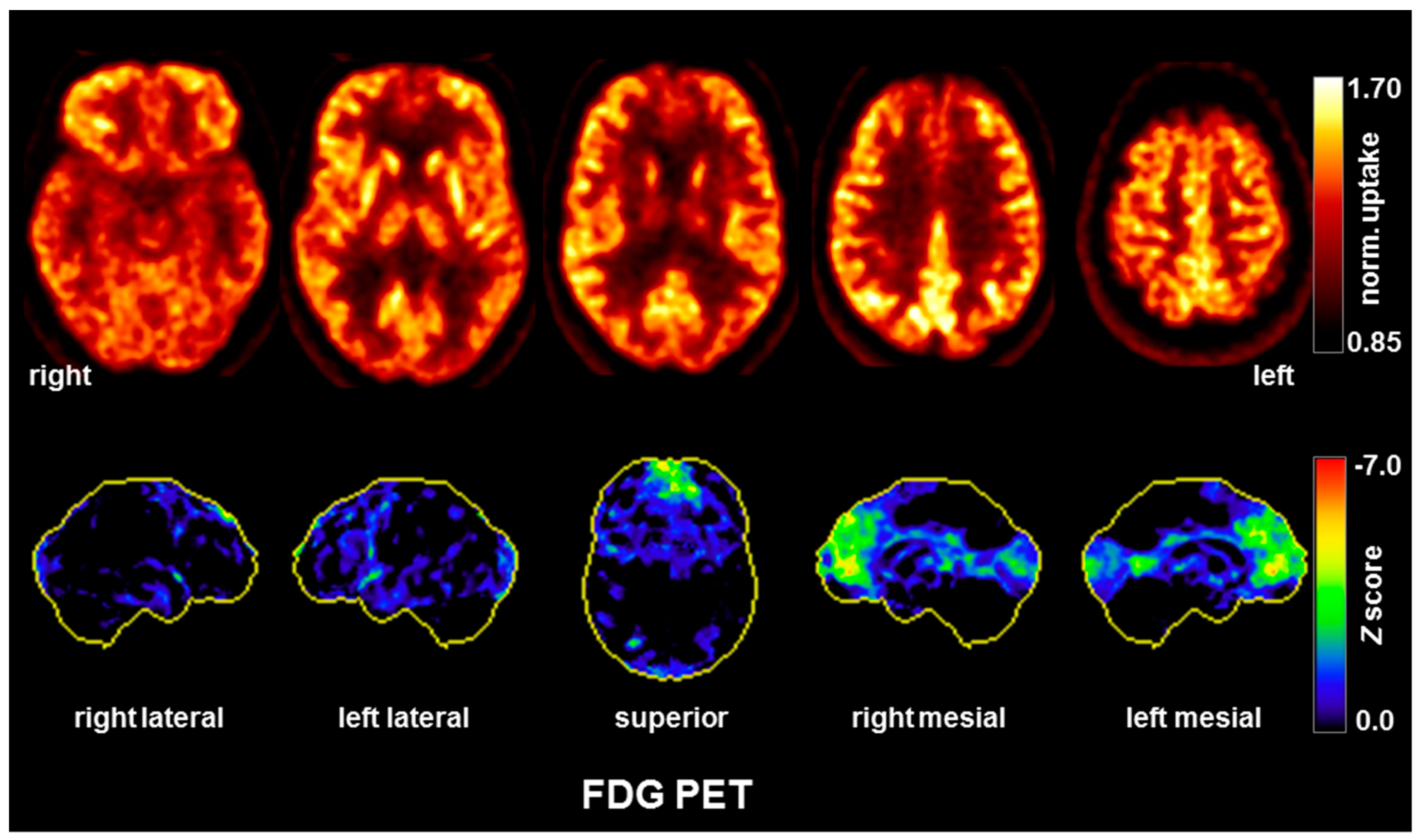 Brainsci 10 00375 g003