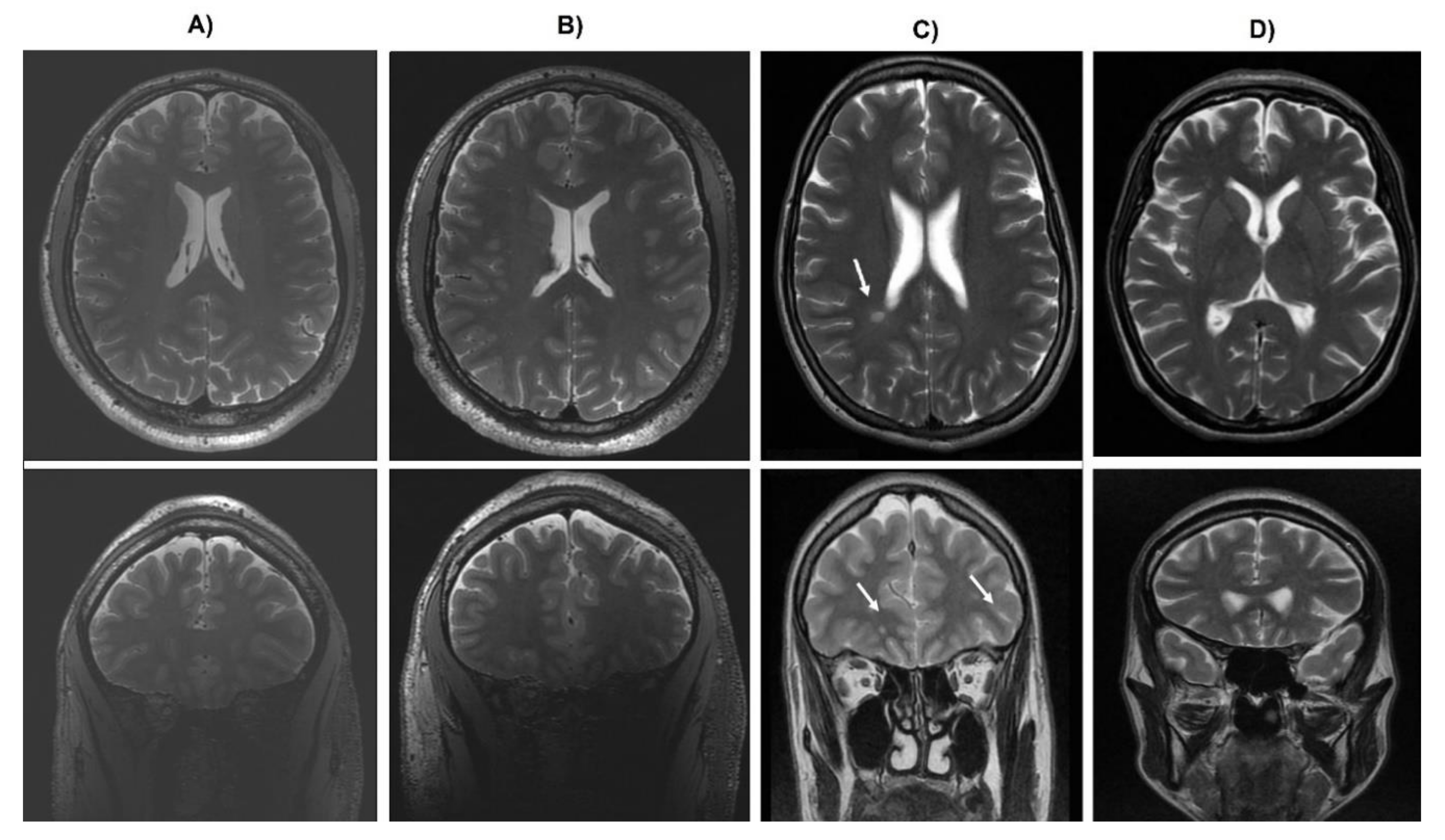 Brainsci 10 00380 g001 Brainsci 10 00380 g001