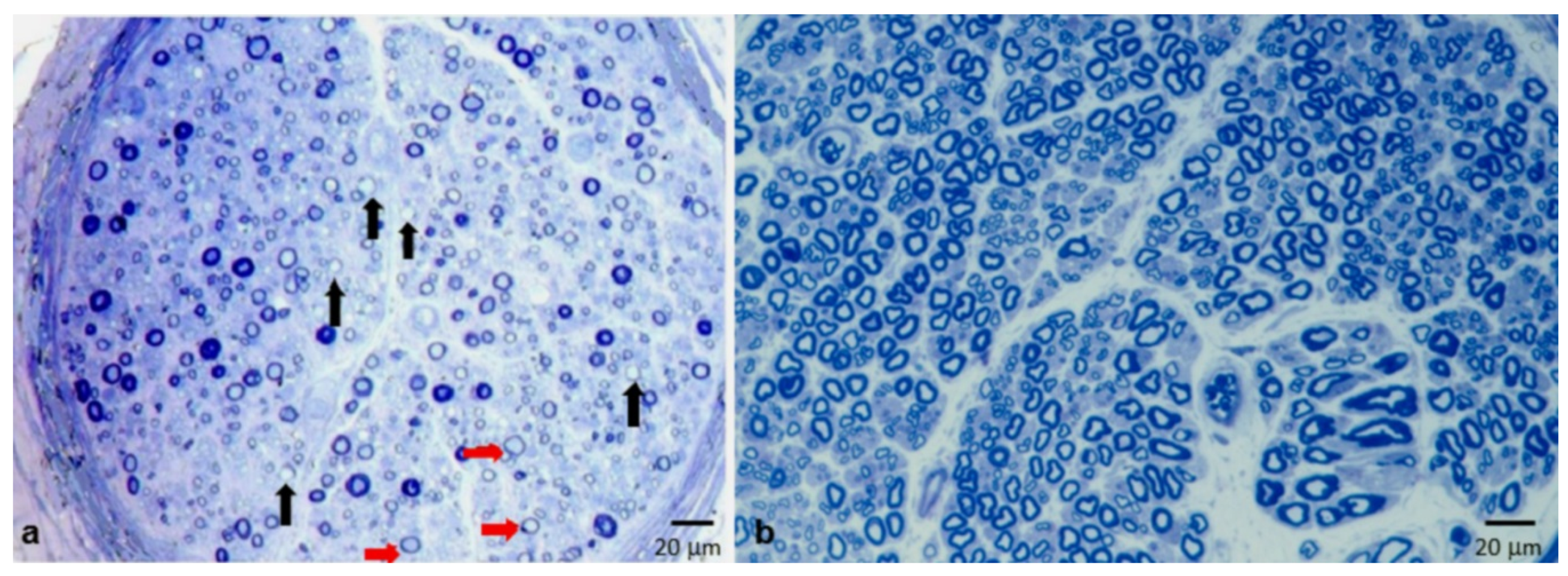 Brainsci 10 00383 g004 Brainsci 10 00383 g004