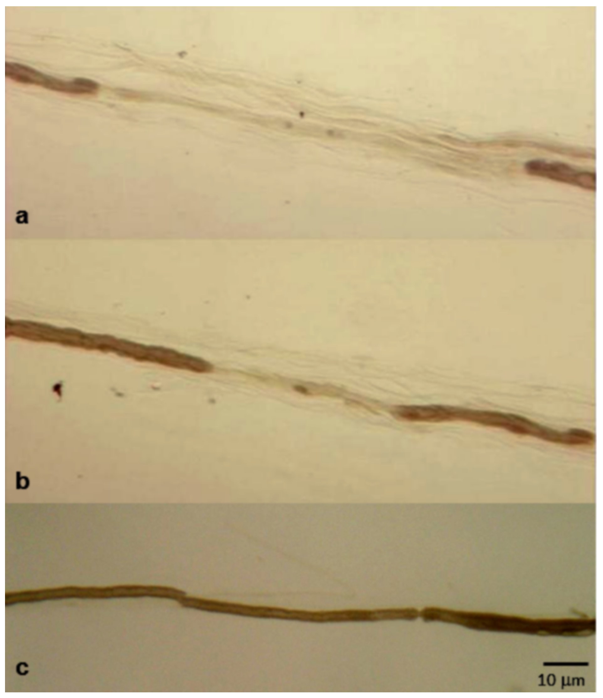 Brainsci 10 00383 g005 Brainsci 10 00383 g005