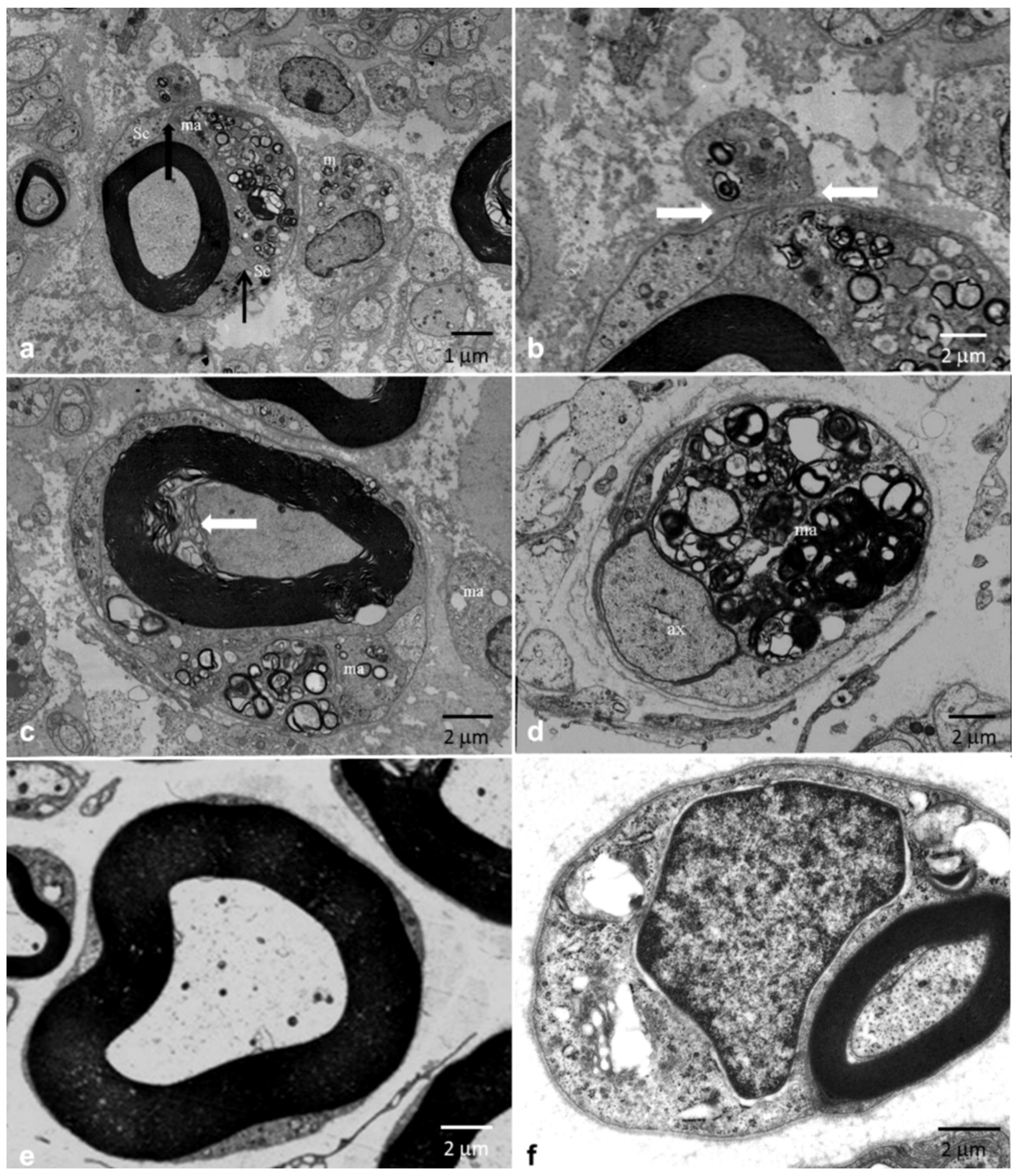 Brainsci 10 00383 g006 Brainsci 10 00383 g006