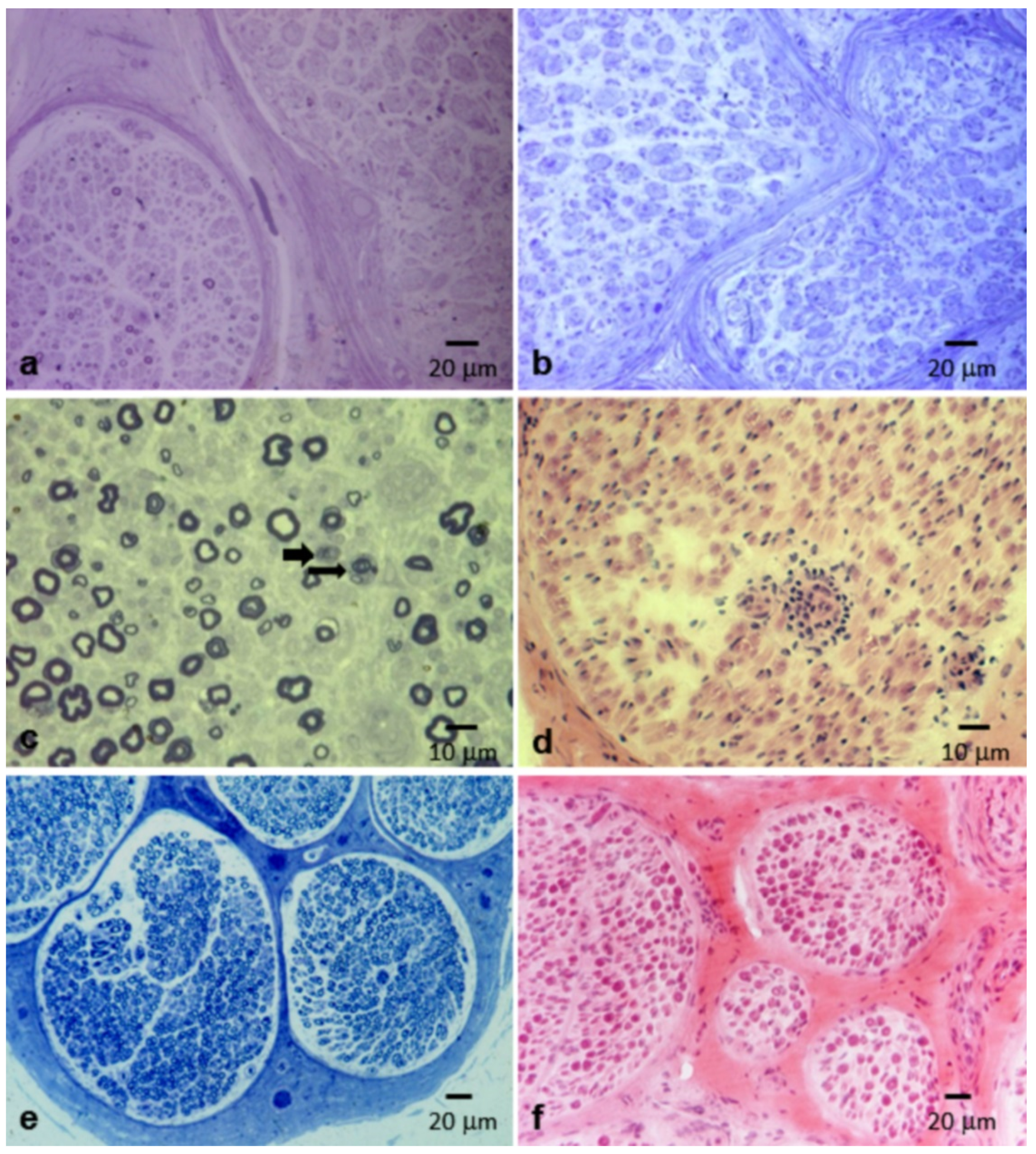 Brainsci 10 00383 g007 Brainsci 10 00383 g007