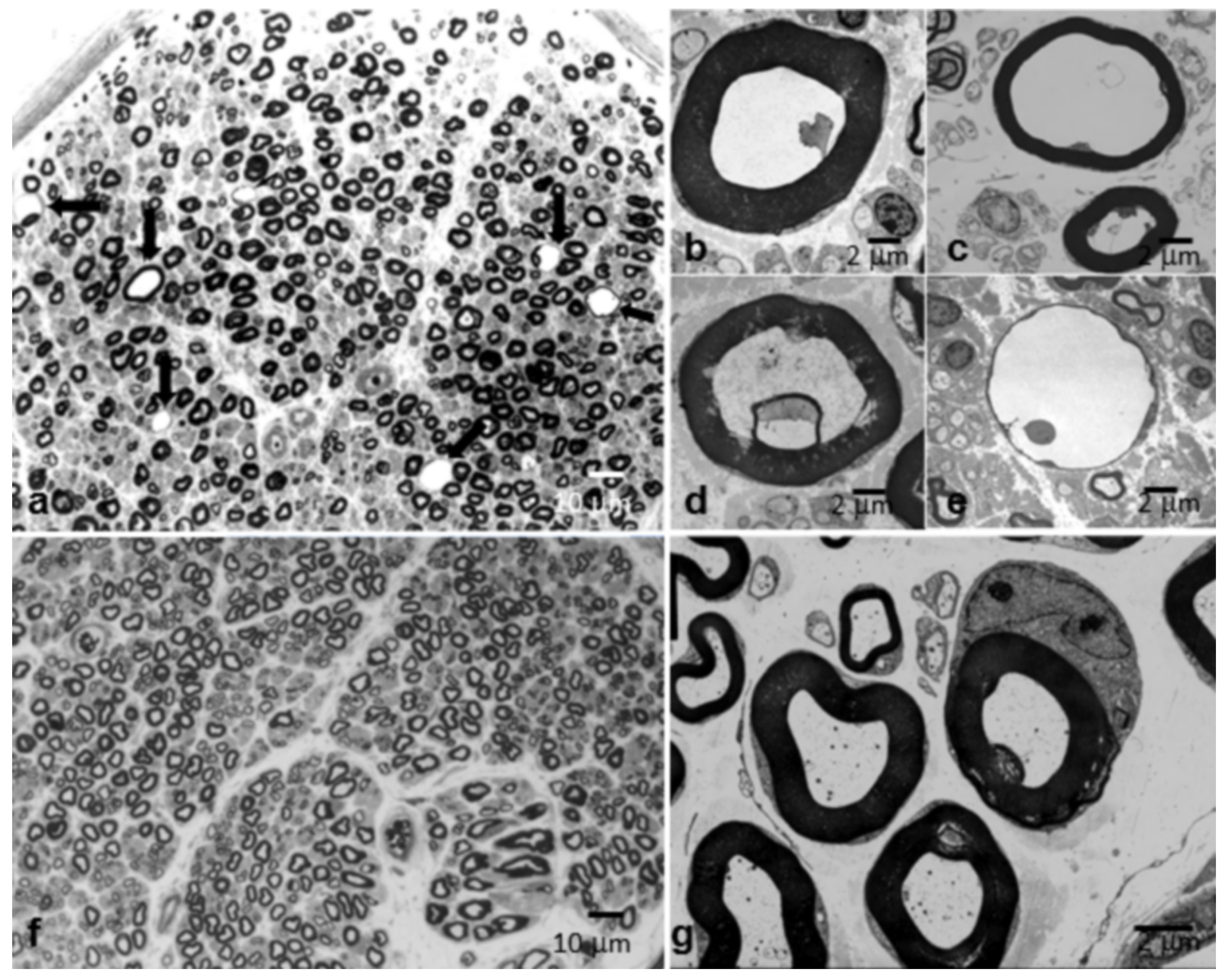 Brainsci 10 00383 g008 Brainsci 10 00383 g008