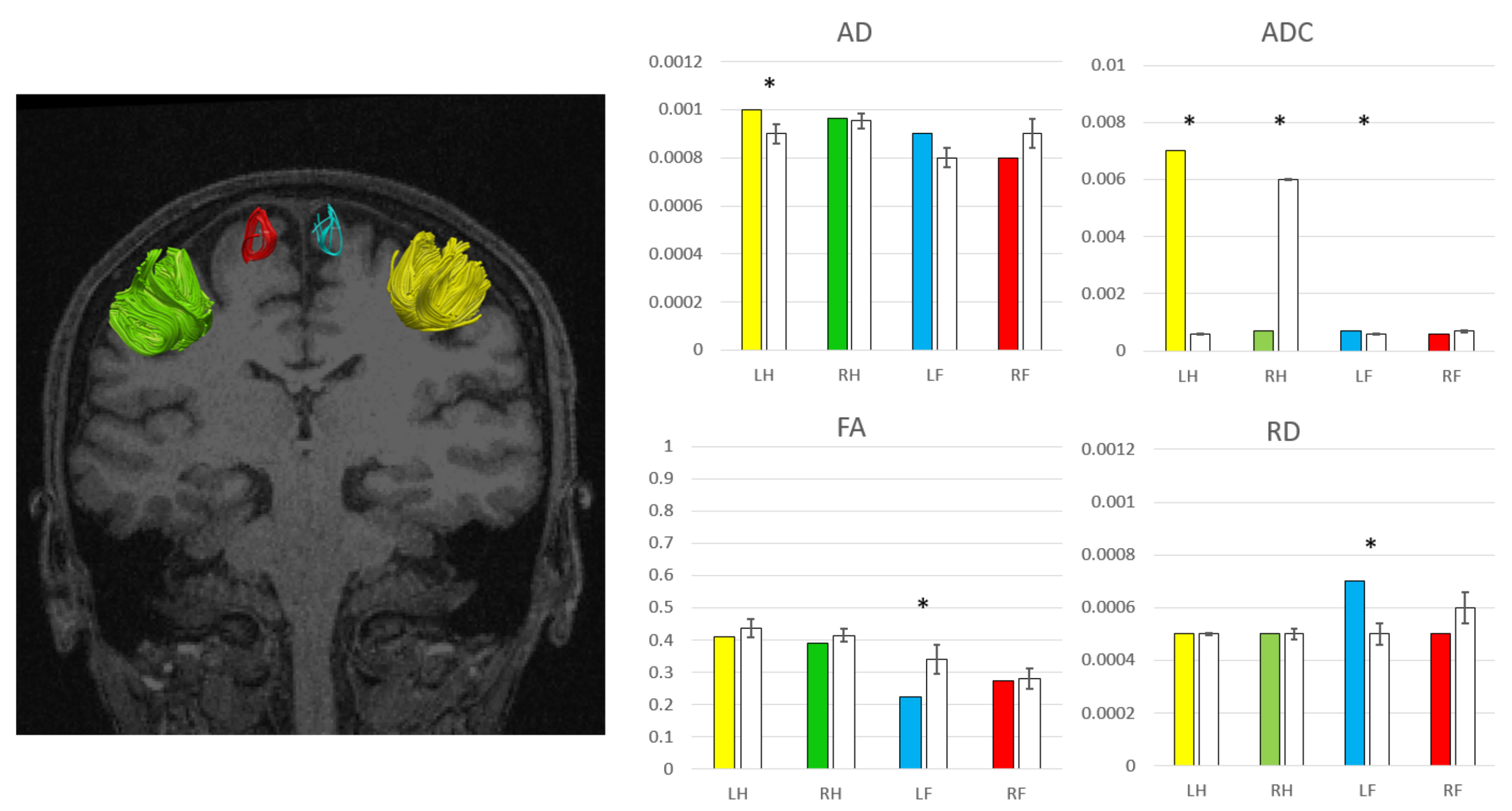 Brainsci 10 00385 g002
