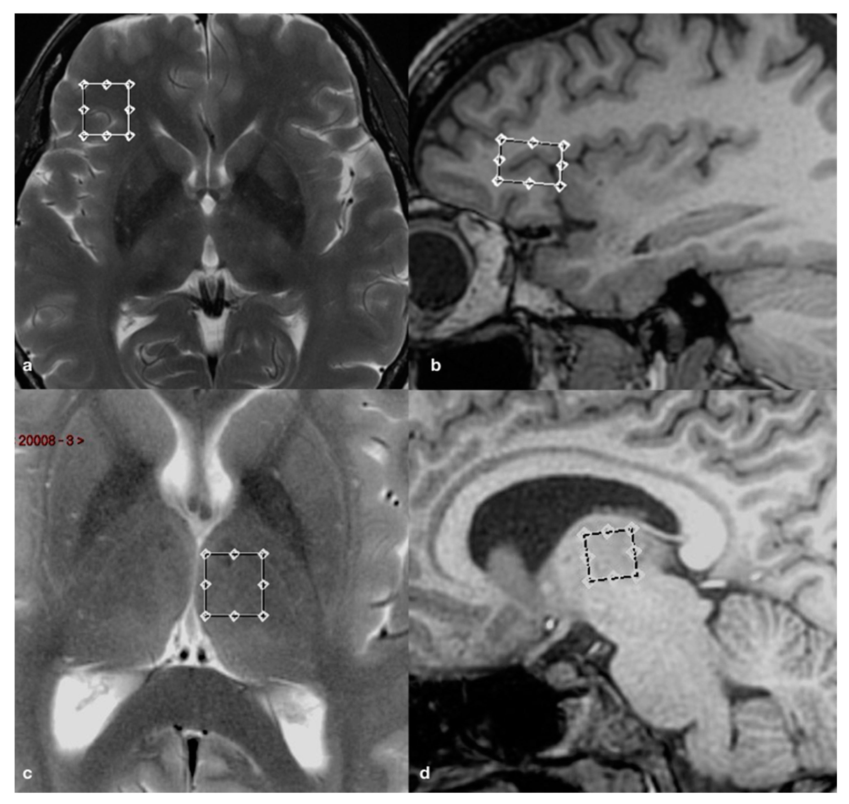 Brainsci 10 00395 g001