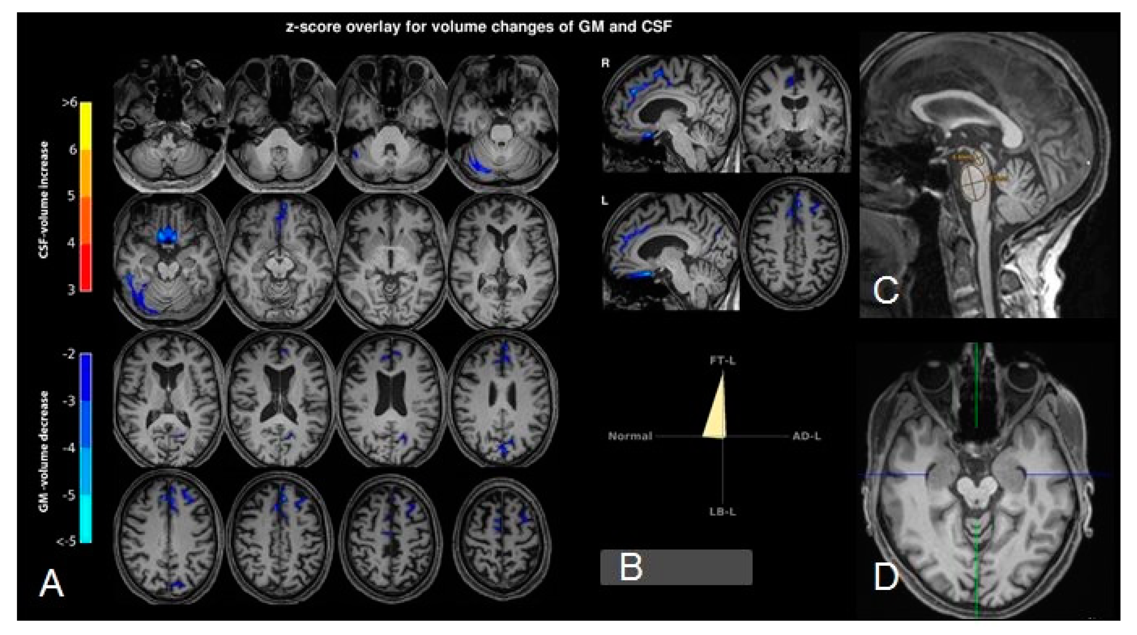 Brainsci 10 00399 g002