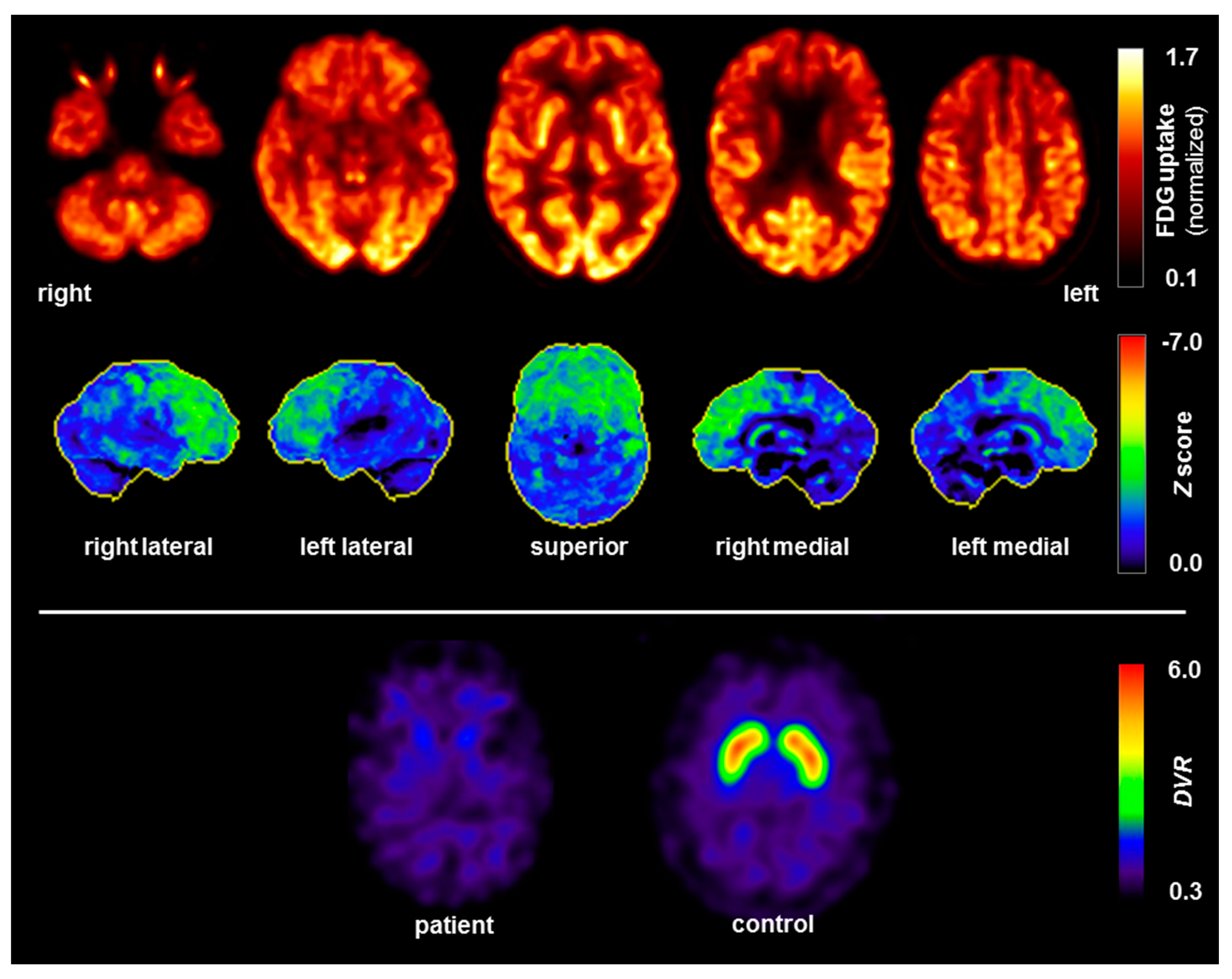 Brainsci 10 00399 g003