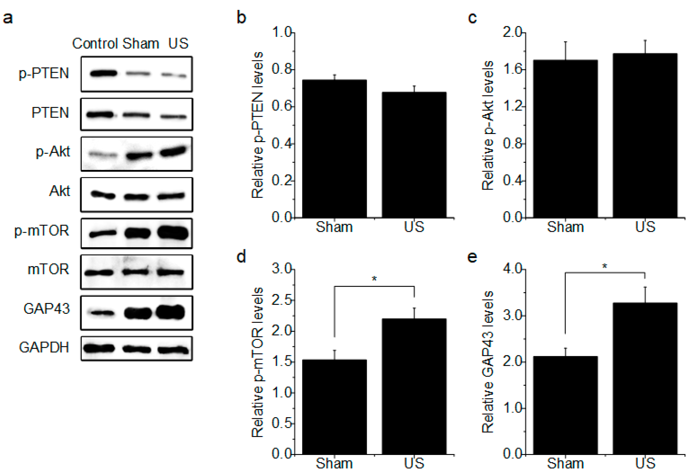 Brainsci 10 00409 g004