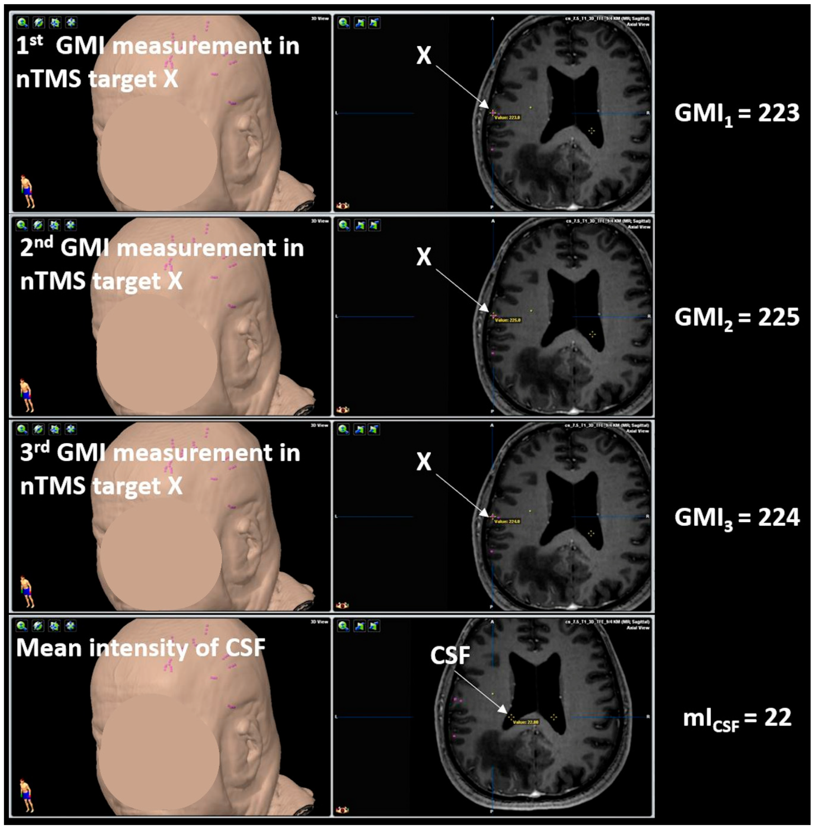 Brainsci 10 00412 g003 Brainsci 10 00412 g003