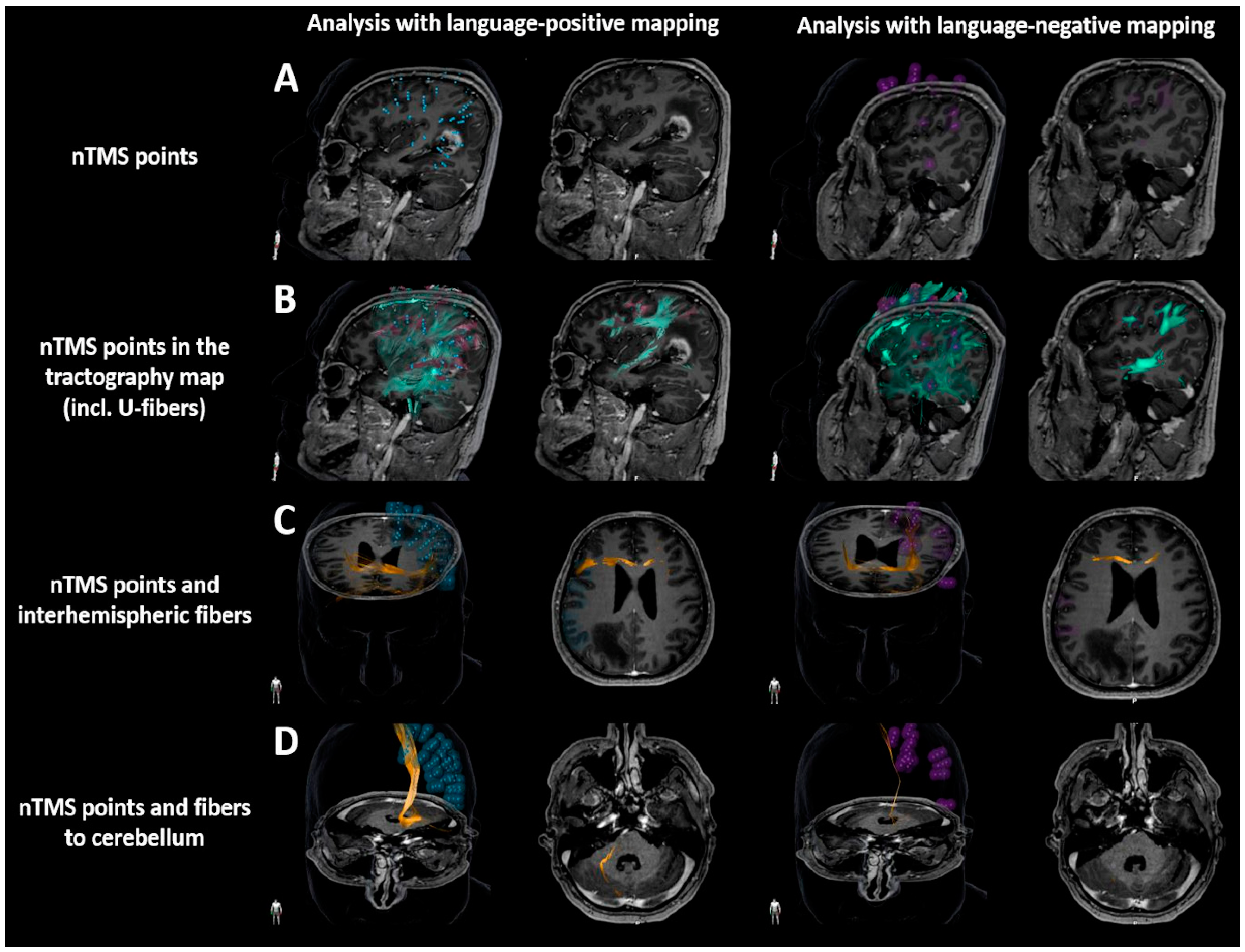 Brainsci 10 00412 g004 Brainsci 10 00412 g004