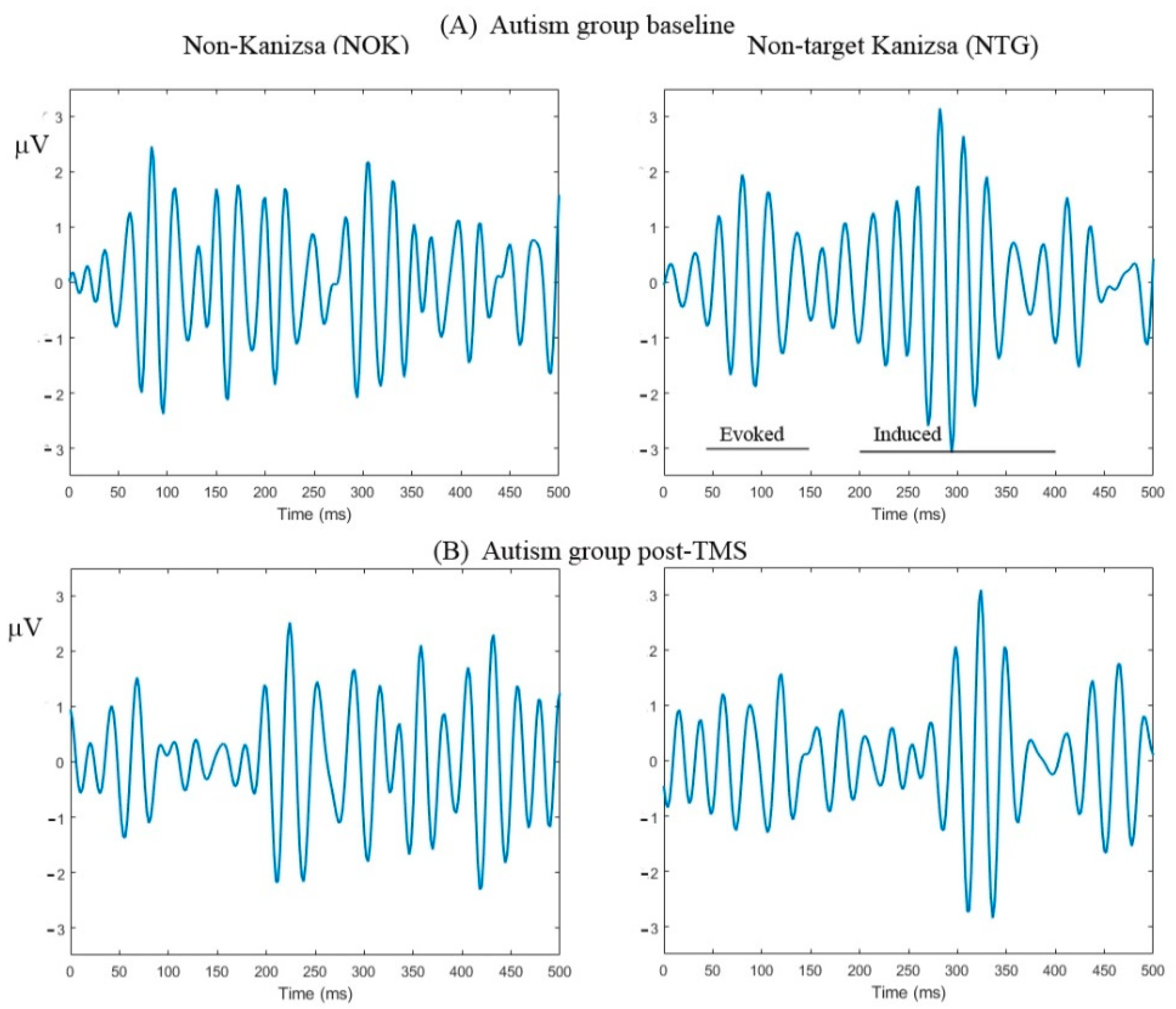 Brainsci 10 00423 g002 Brainsci 10 00423 g002