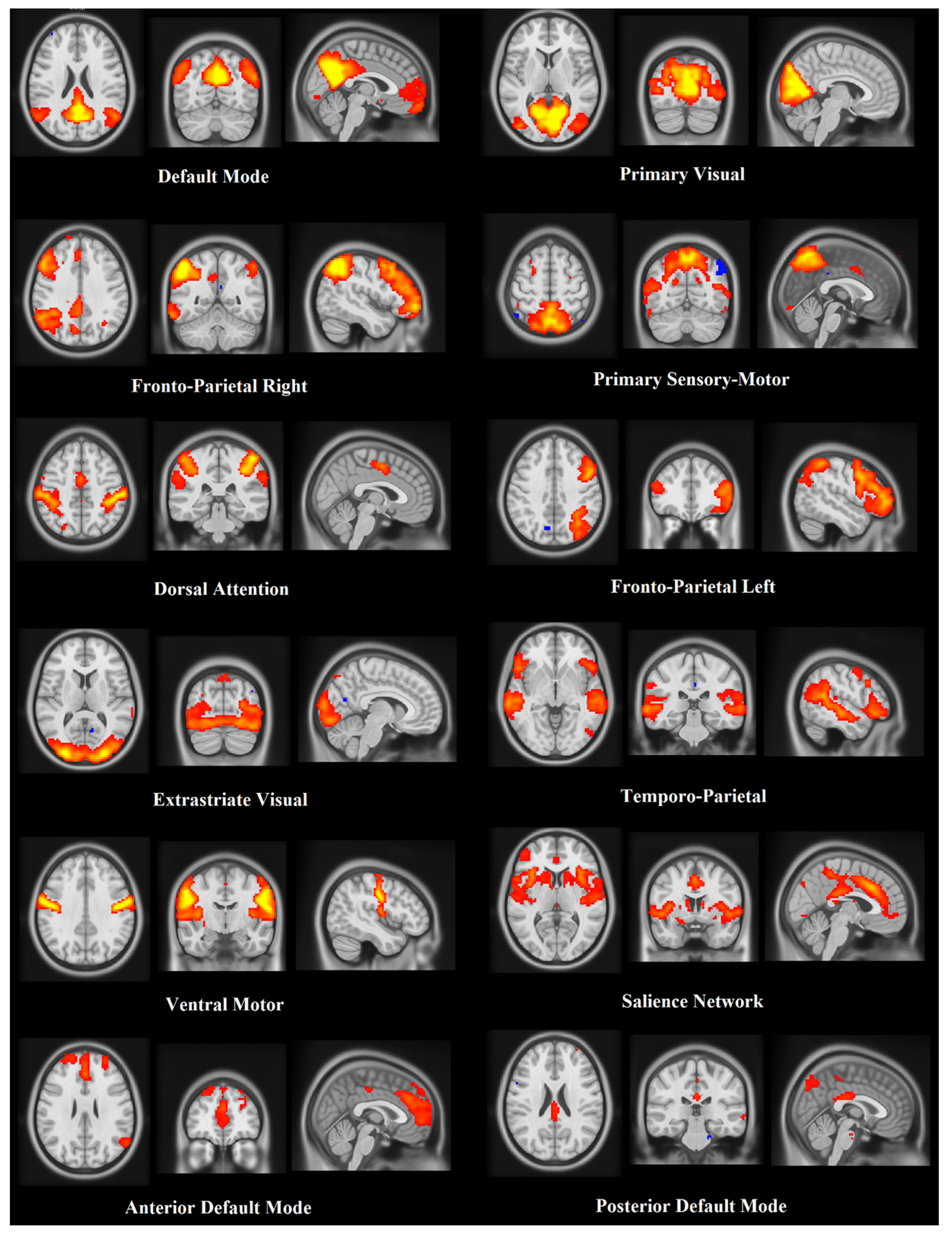 Brainsci 10 00430 g001 Brainsci 10 00430 g001