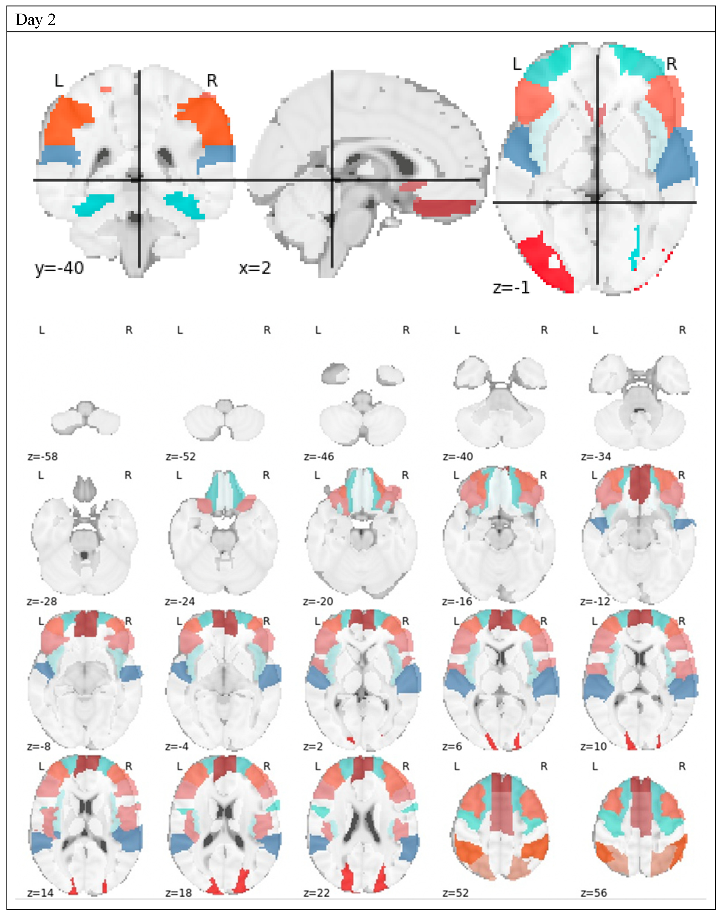 Brainsci 10 00456 g003b Brainsci 10 00456 g003b