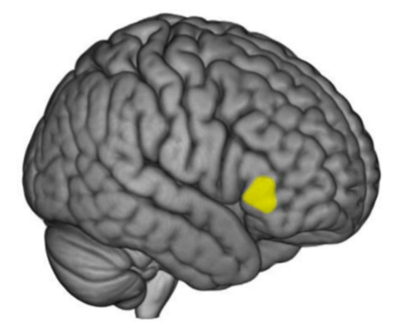 Brainsci 10 00477 g003 Brainsci 10 00477 g003