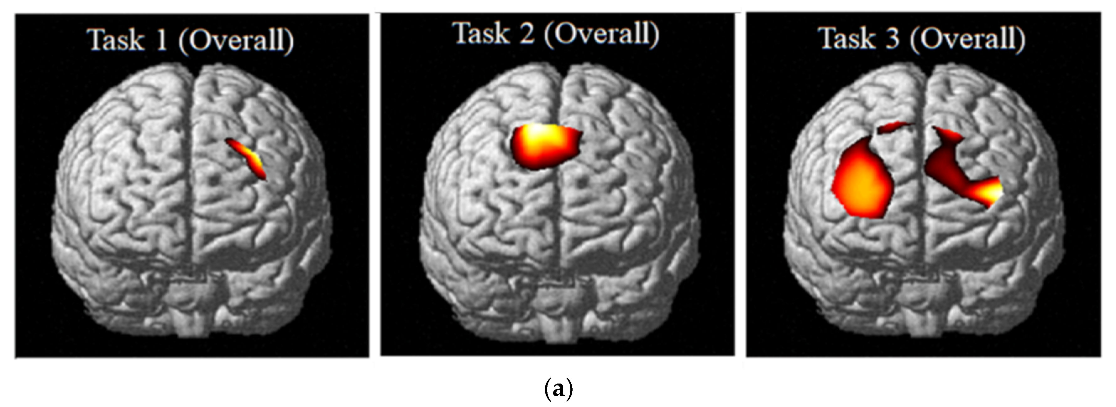 ihbm 2018 human brain mapping ihbm 2018 human brain mapping