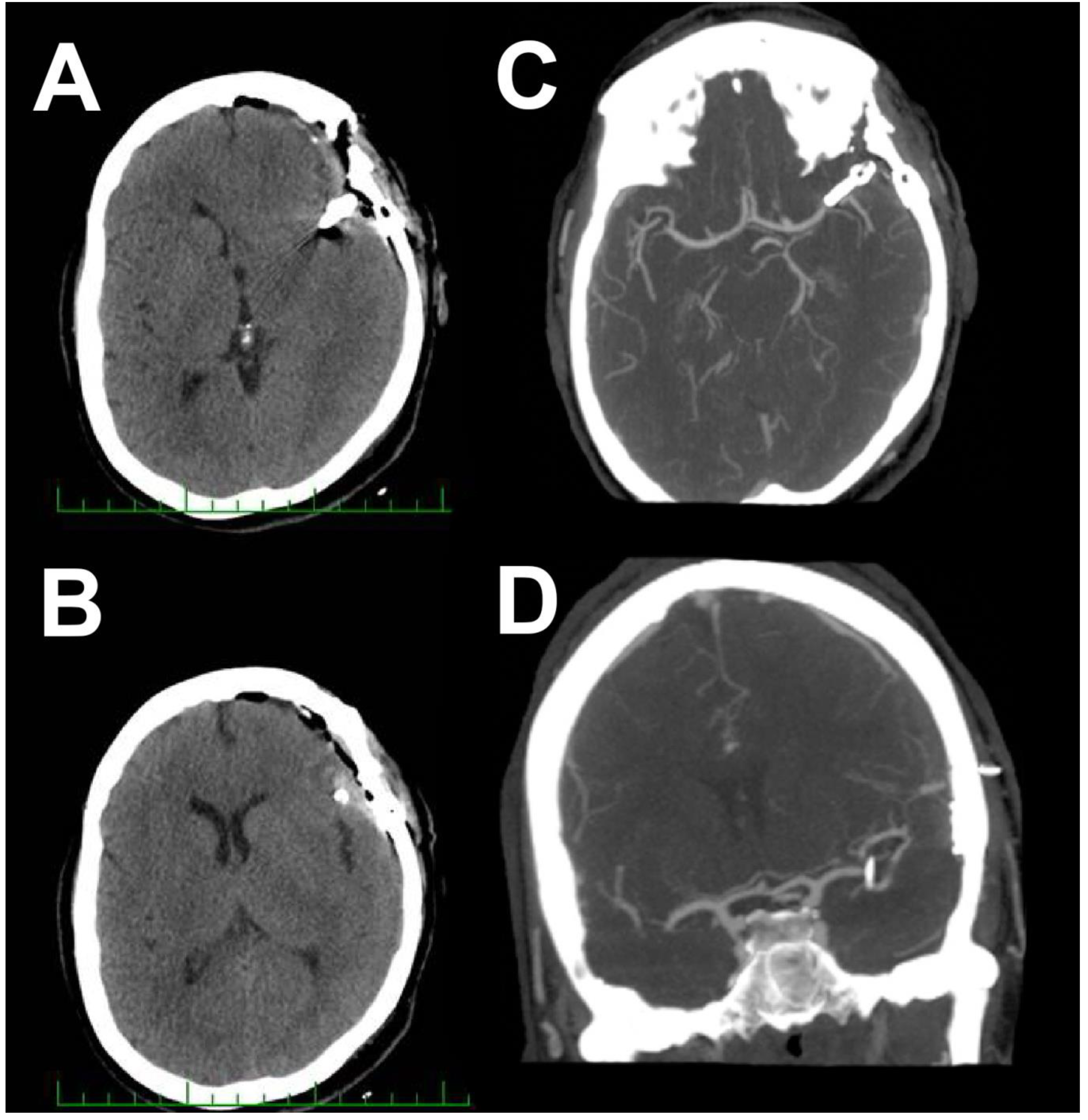 Brainsci 10 00495 g002 Brainsci 10 00495 g002