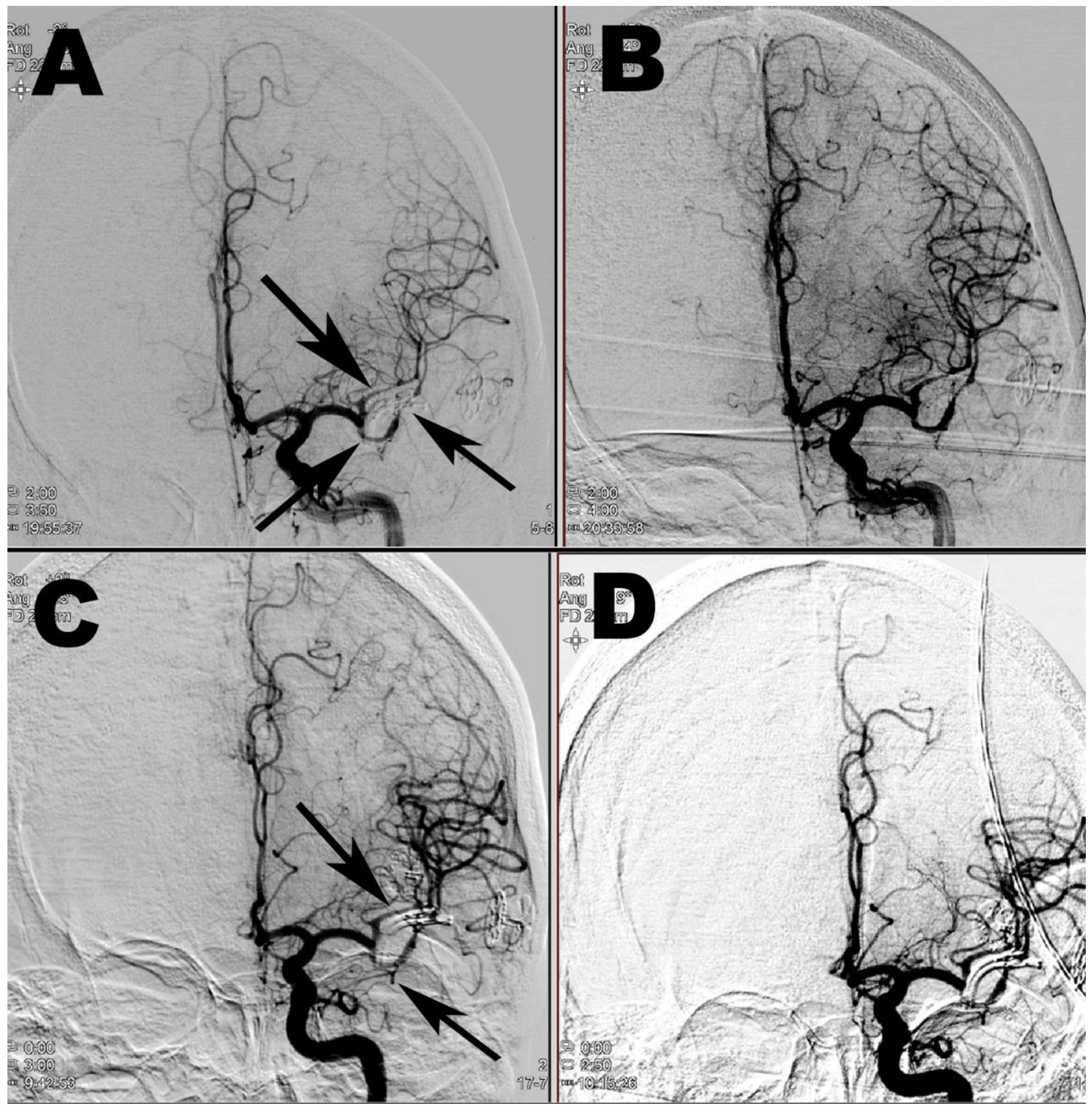 Brainsci 10 00495 g003 Brainsci 10 00495 g003