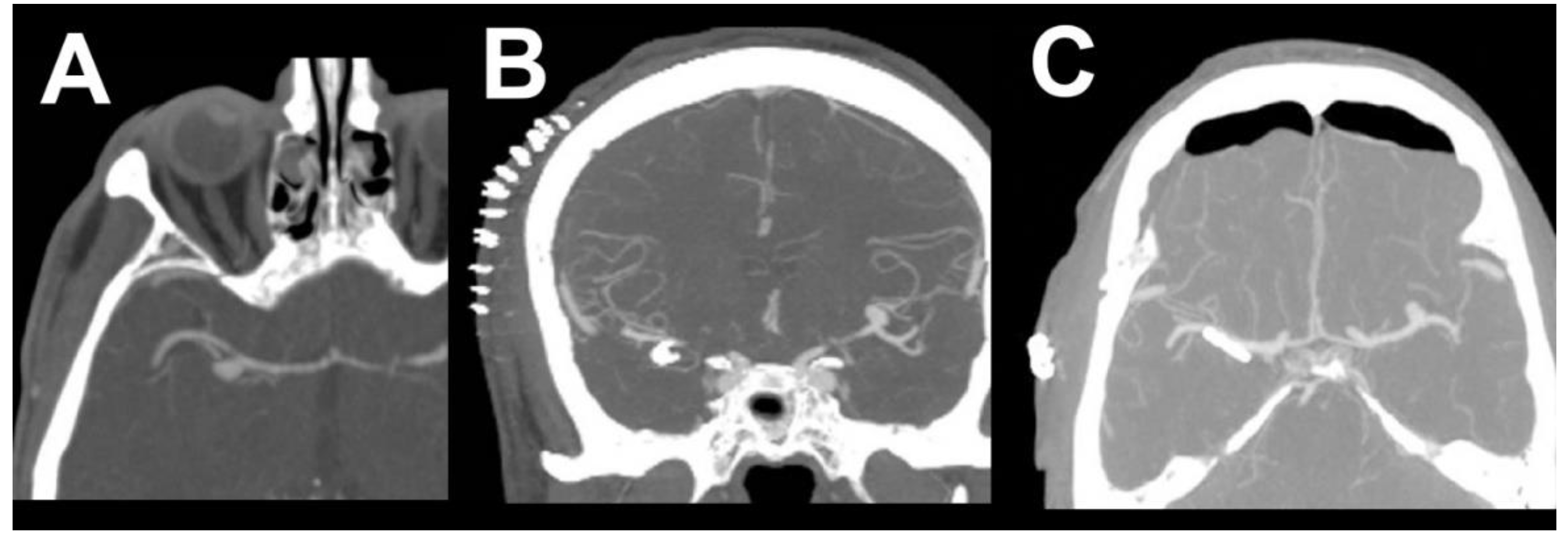 Brainsci 10 00495 g005 Brainsci 10 00495 g005