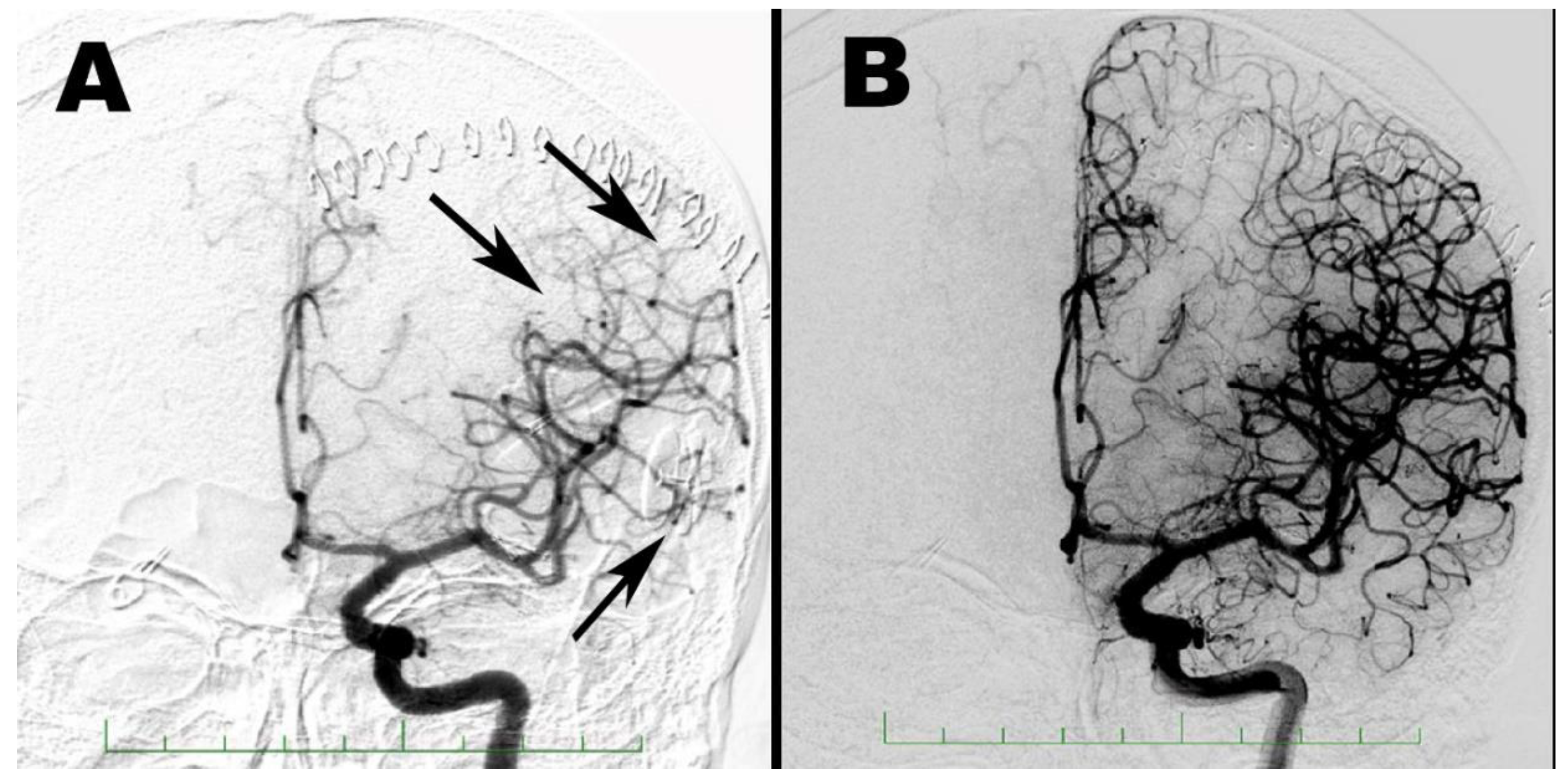 Brainsci 10 00495 g007 Brainsci 10 00495 g007