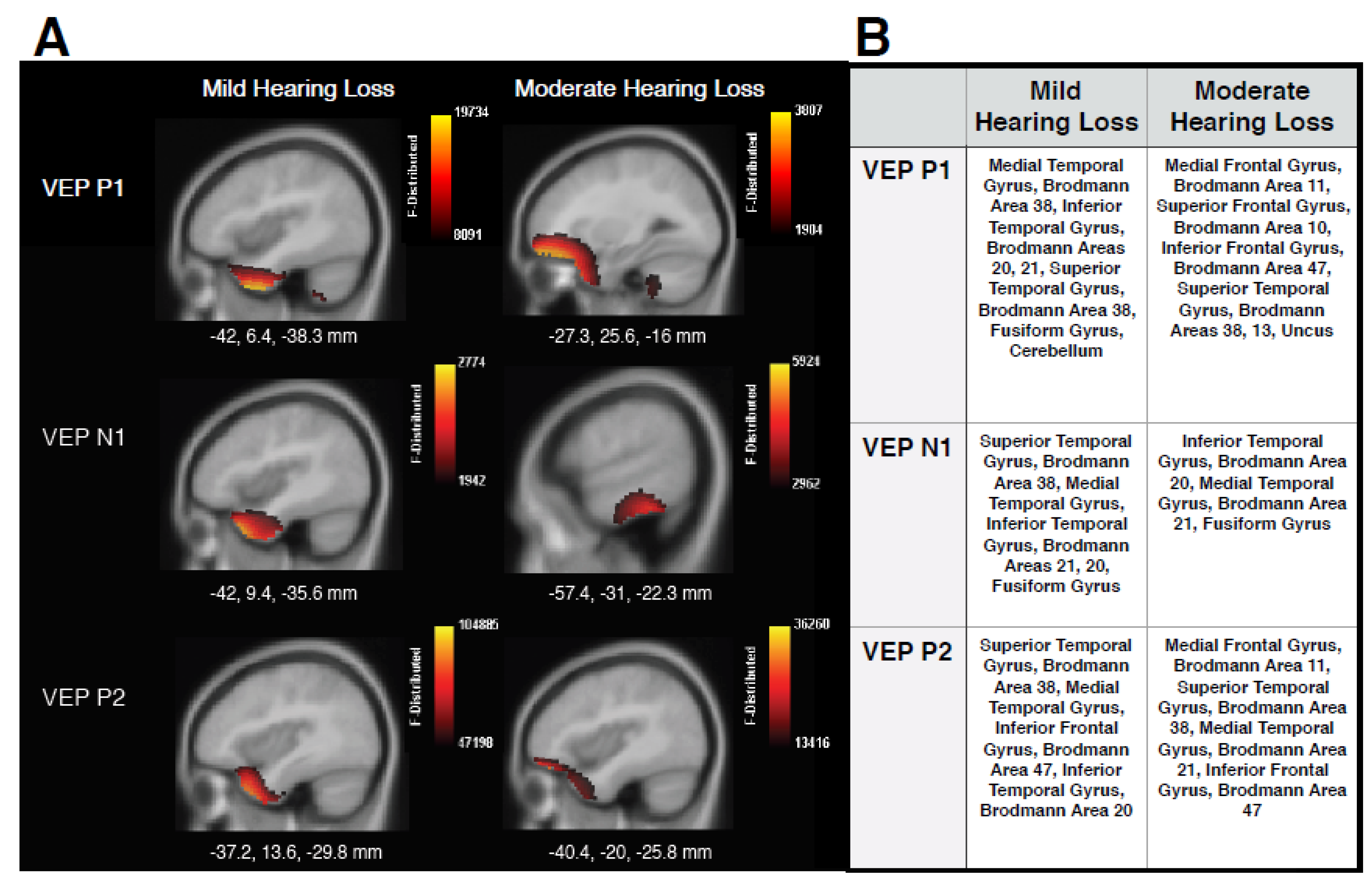 Brainsci 10 00498 g003 Brainsci 10 00498 g003