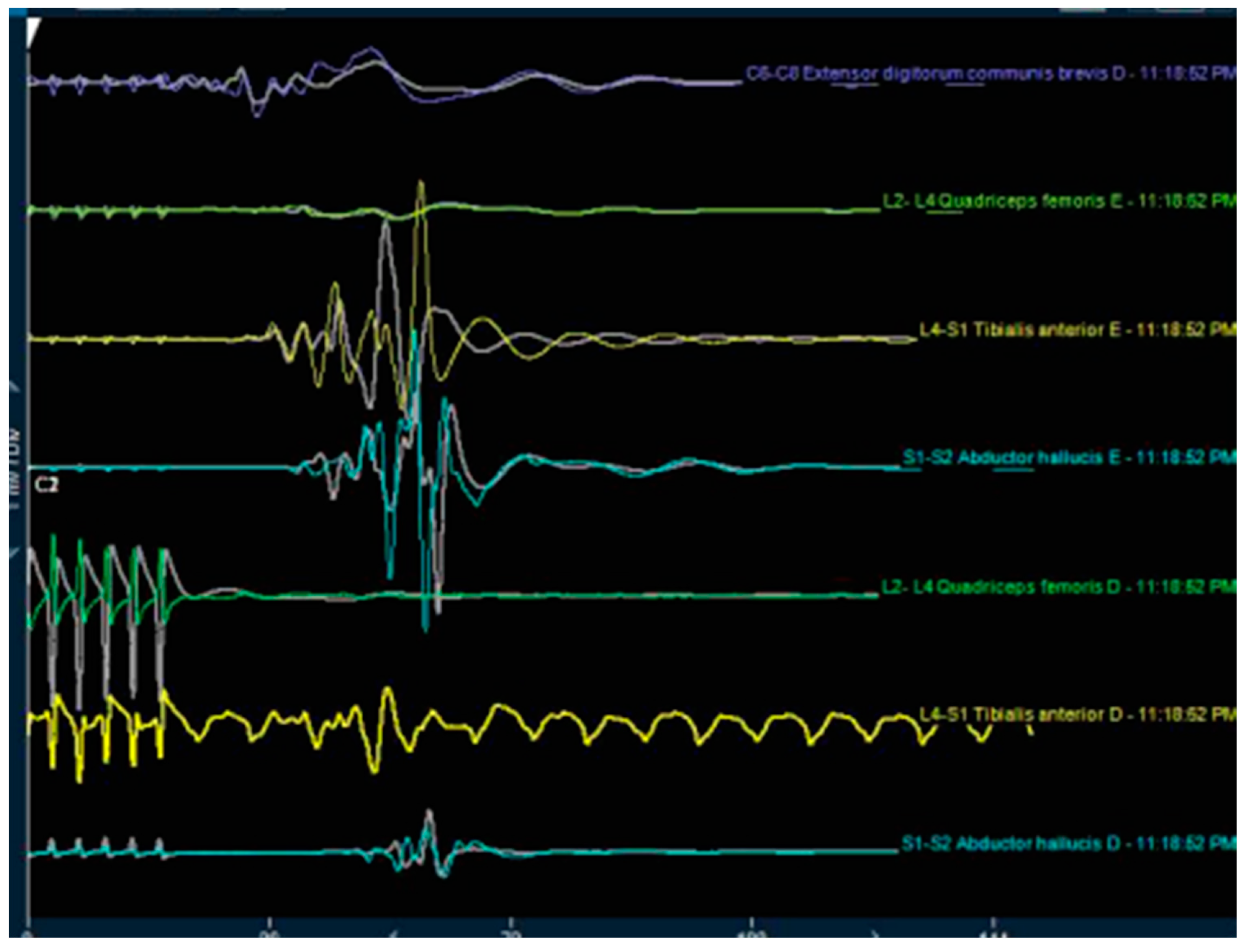 Brainsci 10 00522 g003 Brainsci 10 00522 g003
