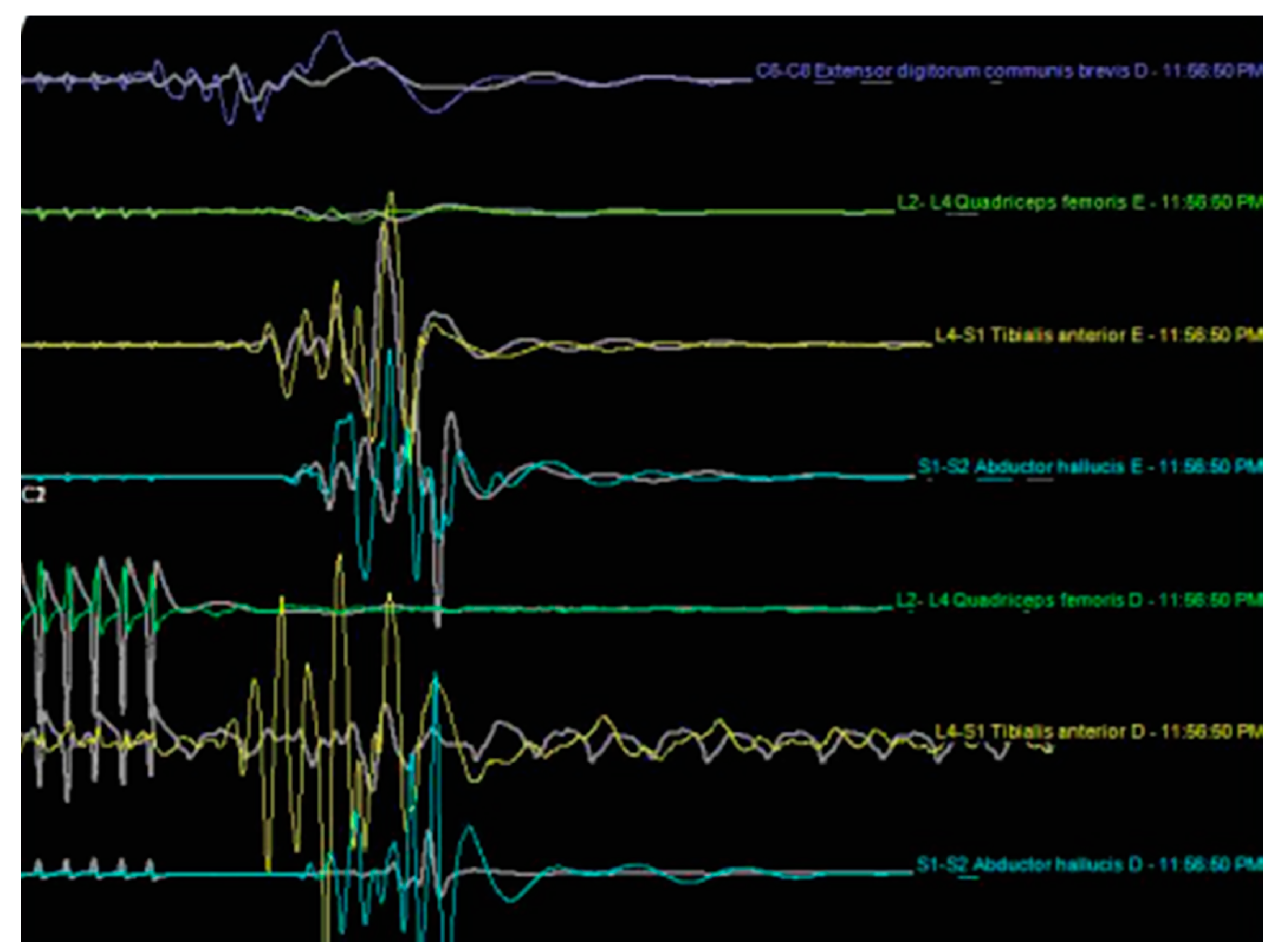 Brainsci 10 00522 g004 Brainsci 10 00522 g004