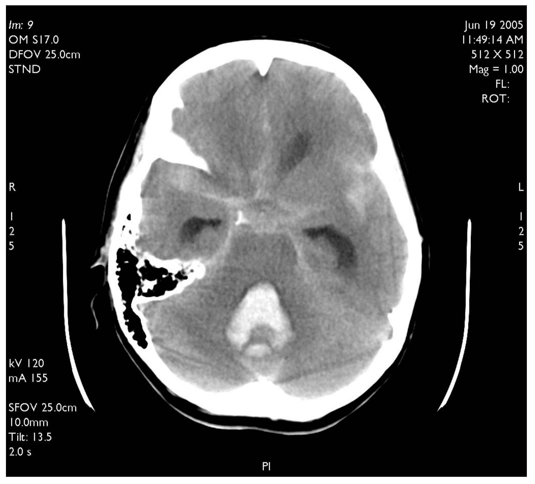 Brainsci 10 00538 g004