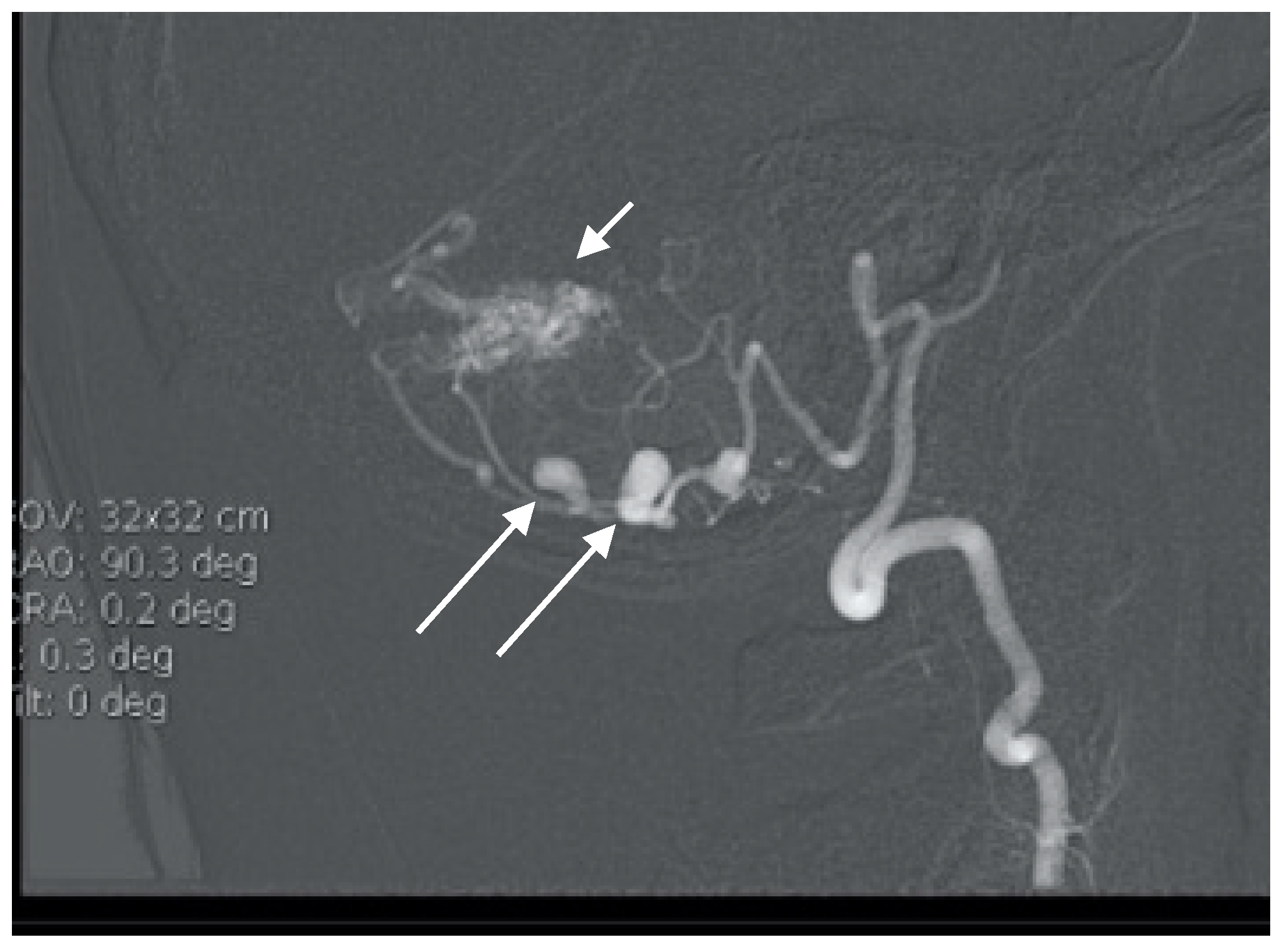 Brainsci 10 00538 g007