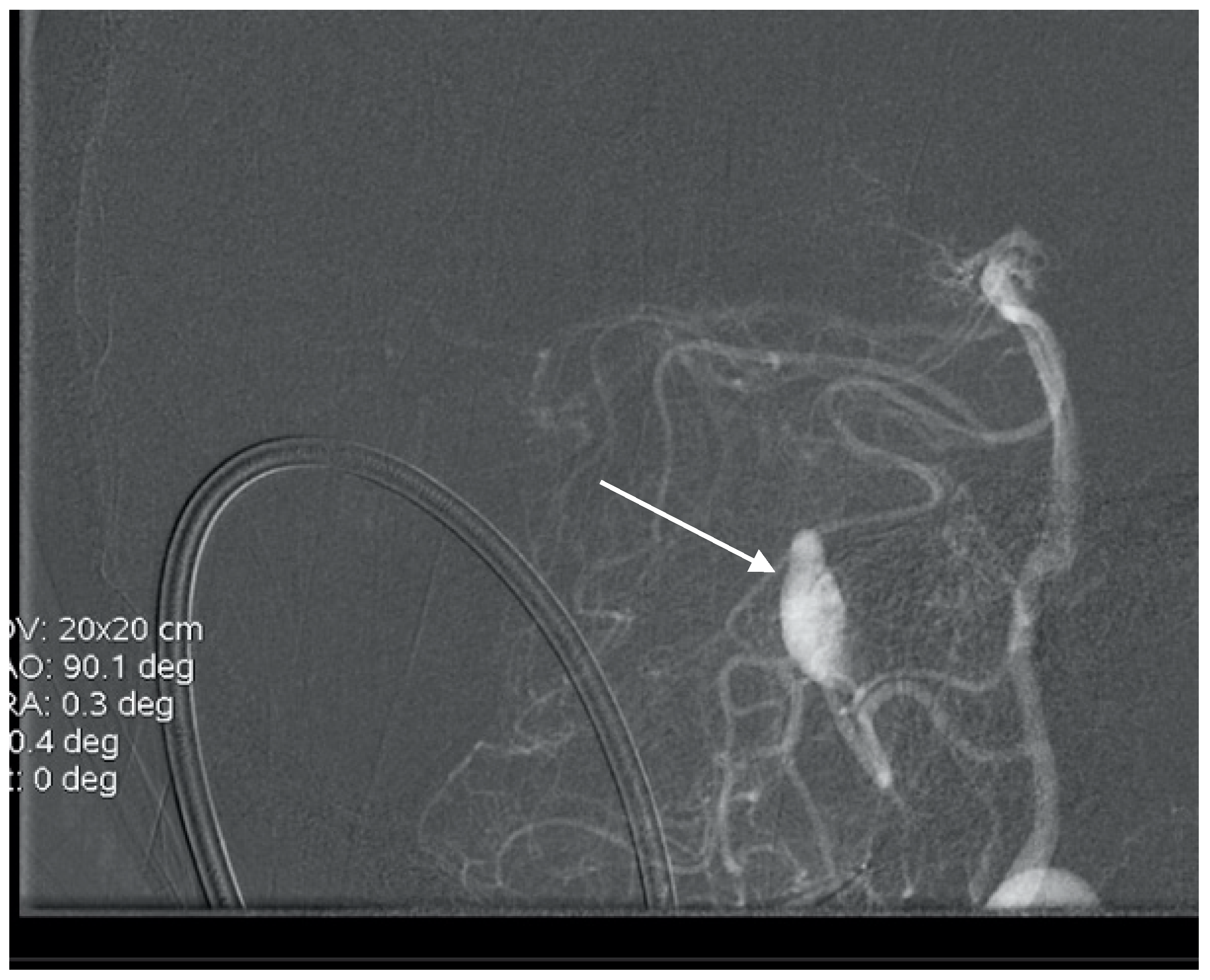Brainsci 10 00538 g011