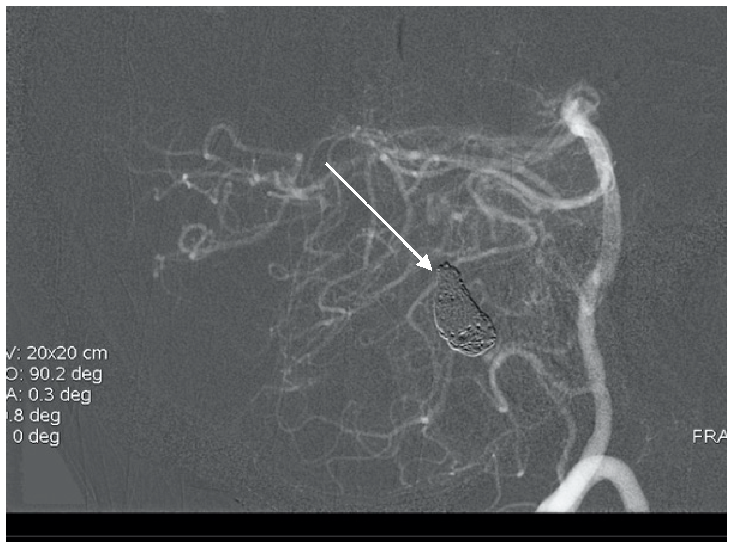 Brainsci 10 00538 g012